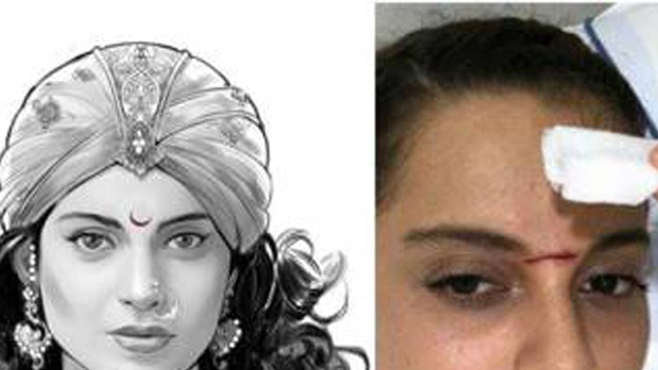 ಶೂಟಿಂಗ್ ವೇಳೆ ಕಂಗನಾ ಹಣೆಗೆ ಖಡ್ಗ ತಗುಲಿ ಗಾಯ ಶೂಟಿಂಗ್ ವೇಳೆ ಕಂಗನಾ ಹಣೆಗೆ ಖಡ್ಗ ತಗುಲಿ ಗಾಯ