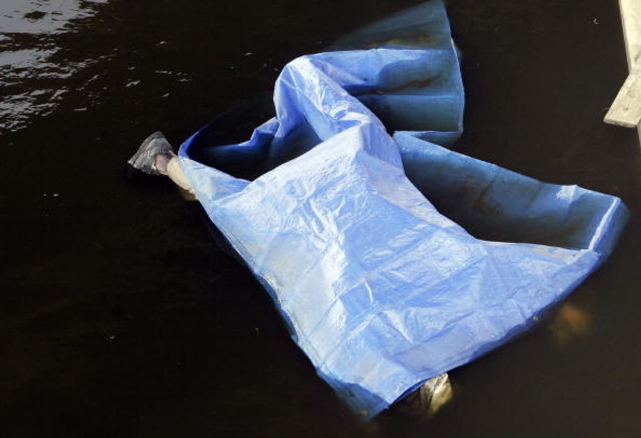 5 Things that happen to your body 10 hours after you die 5 Things that happen to your body 10 hours after you die