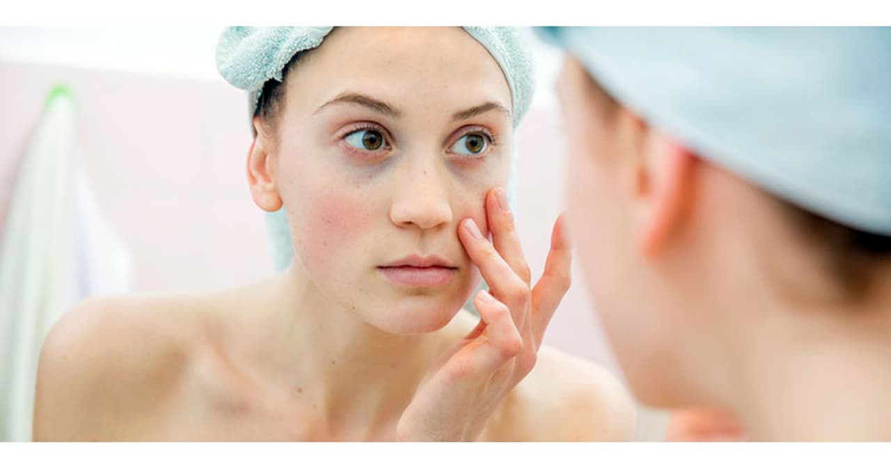 <p>Dark circles are one of the banes of one’s existence and can make one rather conscious.&nbsp;</p>