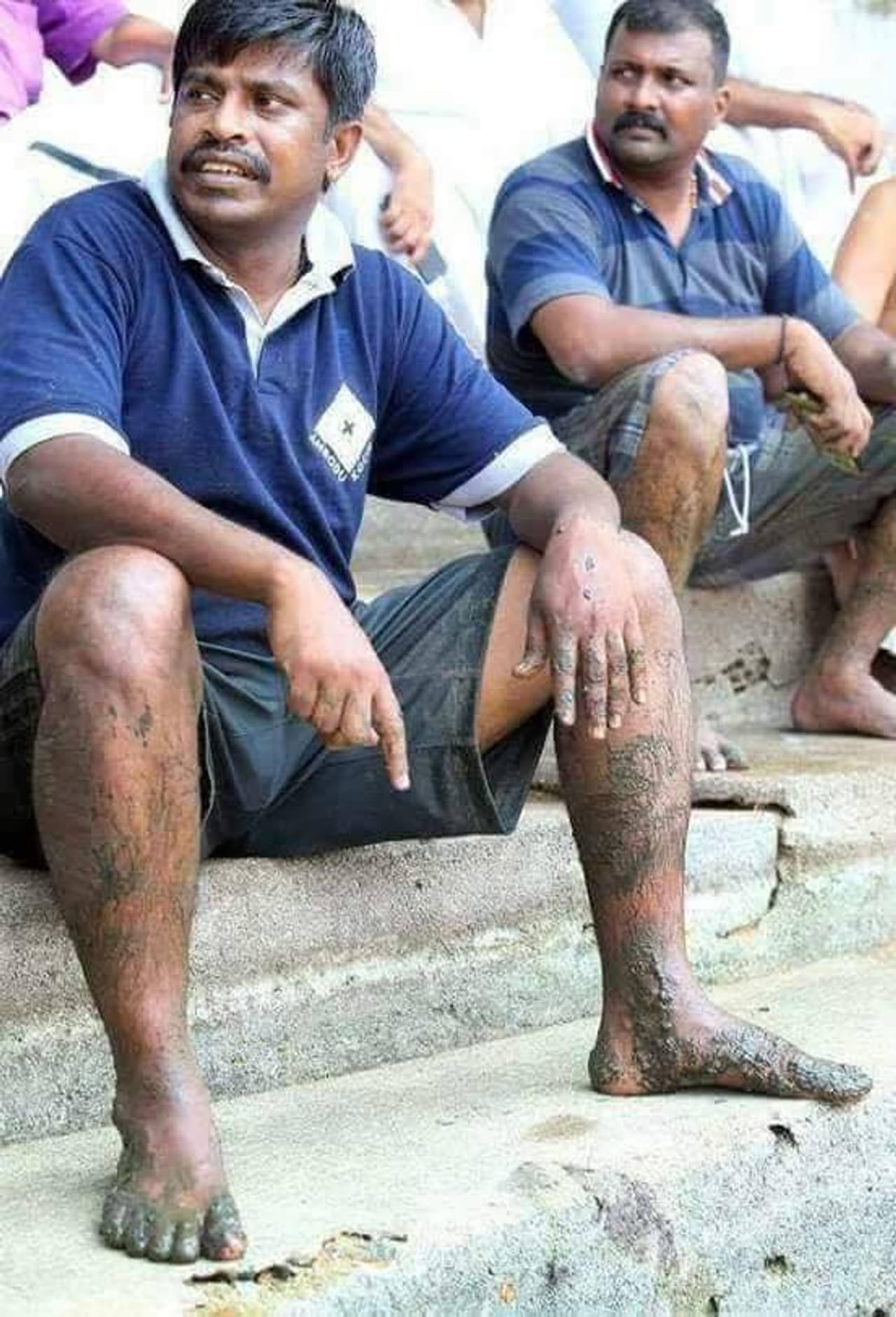 ನೀಲಿ ಬಣ್ಣದ ಟೀ ಶರ್ಟ್ ತೊಟ್ಟು, ಕಾಲೆಲ್ಲಾ ಕೆಸರು ಮೆತ್ತಿಕೊಂಡು ಕೂತಿರುವ ಈ ವ್ಯಕ್ತಿ ಎರ್ನಾಕುಳಂ ಜಿಲ್ಲಾಧಿಕಾರಿ ಎಂ.ಜಿ. ರಾಜಮಾಣಿಕಂ. ಕೇರಳ ಪ್ರವಾಹದ ಹಿನ್ನೆಲೆಯಲ್ಲಿ ವಯನಾಡ್ ವಿಭಾಗದ ರಕ್ಷಣಾ ಕಾರ್ಯದ ಮೇಲುಸ್ತುವಾರಿ ವಹಿಸಿಕೊಂಡಿರುವ ಅವರು ಕ್ಯಾಮೆರಾ ಕಣ್ಣಿಗೆ ಕಂಡಿದ್ದು ಹೀಗೆ...