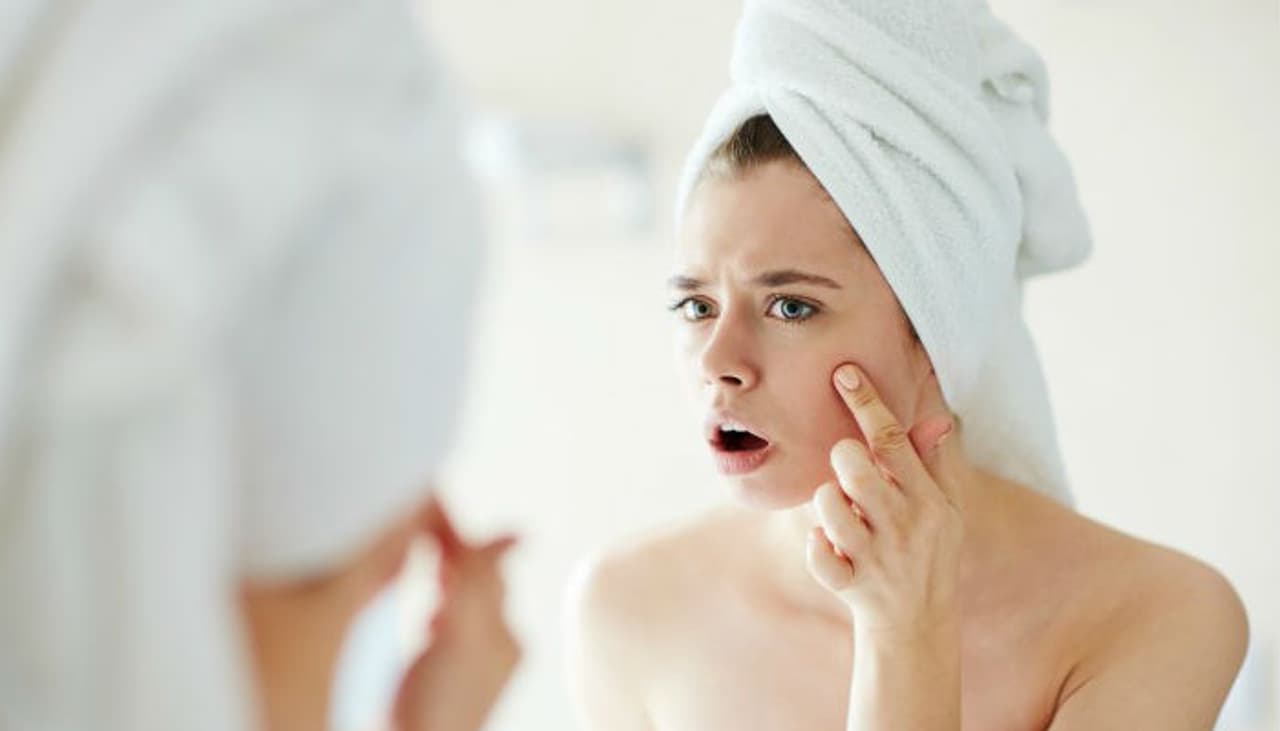 <p>Acne breakouts can be quite annoying, especially when they start popping right on the face. You might not even notice but your favourite foods could be the reason for those zits all over your face. Yes, you read that right. There are times when consumption of some foods can do more harm than good to your body.</p> <p>Acne breakouts can be quite annoying, especially when they start popping right on the face. You might not even notice but your favourite foods could be the reason for those zits all over your face. Yes, you read that right. There are times when consumption of some foods can do more harm than good to your body.</p>