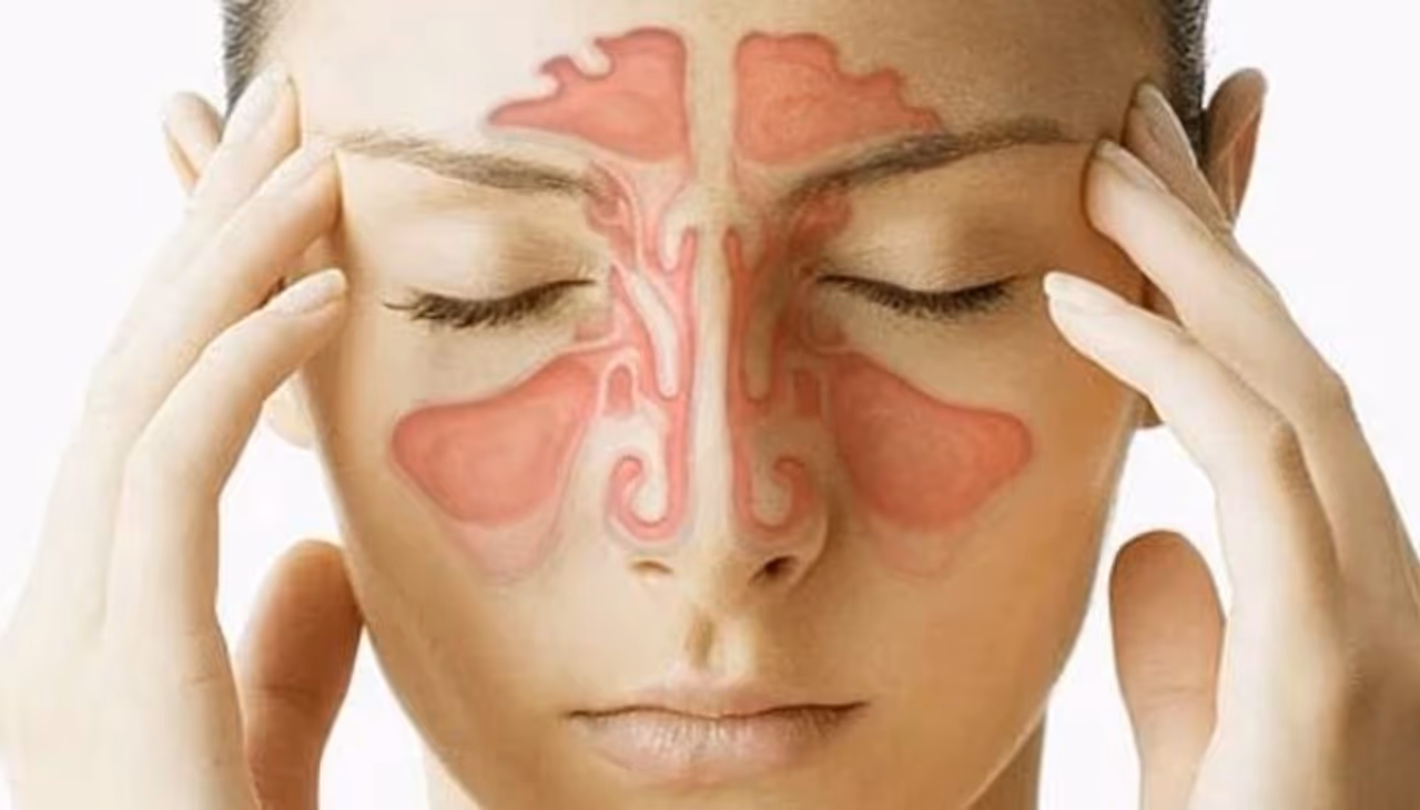 <p>Sinuses are air filled cavities located on either side of the nose. Due to allergies, cold, or bacterial infections, these may sometimes get clogged or infected. This can create various complications like headache, snoring or difficulty in breathing. In serious cases, a sinus infection may even lead to brain fever or meningitis.</p> <p>Sinuses are air filled cavities located on either side of the nose. Due to allergies, cold, or bacterial infections, these may sometimes get clogged or infected. This can create various complications like headache, snoring or difficulty in breathing. In serious cases, a sinus infection may even lead to brain fever or meningitis.</p>