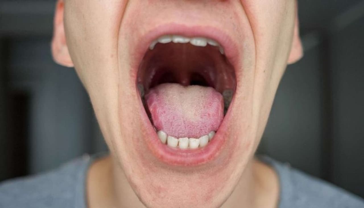 <p style="text align: justify;">ನಿಮ್ಮ ಆಹಾರದ ಹೊರತಾಗಿ, ನಿದ್ರೆ, ರೋಗ, ಬ್ಯಾಕ್ಟೀರಿಯಾಗಳ ಕೊರತೆಯಿಂದಾಗಿ, ನಾಲಿಗೆಯ ಬಣ್ಣ ಬದಲಾಗುತ್ತದೆ. ಆರೋಗ್ಯಕರ ನಾಲಿಗೆಯ ಬಣ್ಣ ತಿಳಿ ಗುಲಾಬಿ. ಆದಾಗ್ಯೂ, ನಾಲಿಗೆಗೆ ಬಿಳಿ ಪದರವನ್ನು ಹೊಂದಿರುವುದನ್ನು ಸಹ ಸಾಮಾನ್ಯವೆಂದು ಪರಿಗಣಿಸಲಾಗುತ್ತದೆ. ನಾಲಿಗೆಯ ಬಣ್ಣದಿಂದ ಆರೋಗ್ಯದ ರಹಸ್ಯವನ್ನು ಹೇಗೆ ಕಲಿಯಬೇಕೆಂದು ನಮಗೆ ತಿಳಿಸ್ತೇವೆ ನೋಡಿ.</p> <p style="text align: justify;">ನಿಮ್ಮ ಆಹಾರದ ಹೊರತಾಗಿ, ನಿದ್ರೆ, ರೋಗ, ಬ್ಯಾಕ್ಟೀರಿಯಾಗಳ ಕೊರತೆಯಿಂದಾಗಿ, ನಾಲಿಗೆಯ ಬಣ್ಣ ಬದಲಾಗುತ್ತದೆ. ಆರೋಗ್ಯಕರ ನಾಲಿಗೆಯ ಬಣ್ಣ ತಿಳಿ ಗುಲಾಬಿ. ಆದಾಗ್ಯೂ, ನಾಲಿಗೆಗೆ ಬಿಳಿ ಪದರವನ್ನು ಹೊಂದಿರುವುದನ್ನು ಸಹ ಸಾಮಾನ್ಯವೆಂದು ಪರಿಗಣಿಸಲಾಗುತ್ತದೆ. ನಾಲಿಗೆಯ ಬಣ್ಣದಿಂದ ಆರೋಗ್ಯದ ರಹಸ್ಯವನ್ನು ಹೇಗೆ ಕಲಿಯಬೇಕೆಂದು ನಮಗೆ ತಿಳಿಸ್ತೇವೆ ನೋಡಿ.</p>