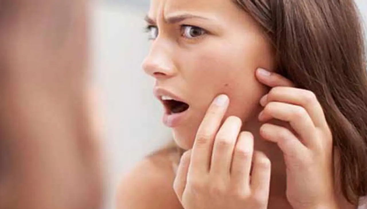 Best Remedies For Pimples On Face