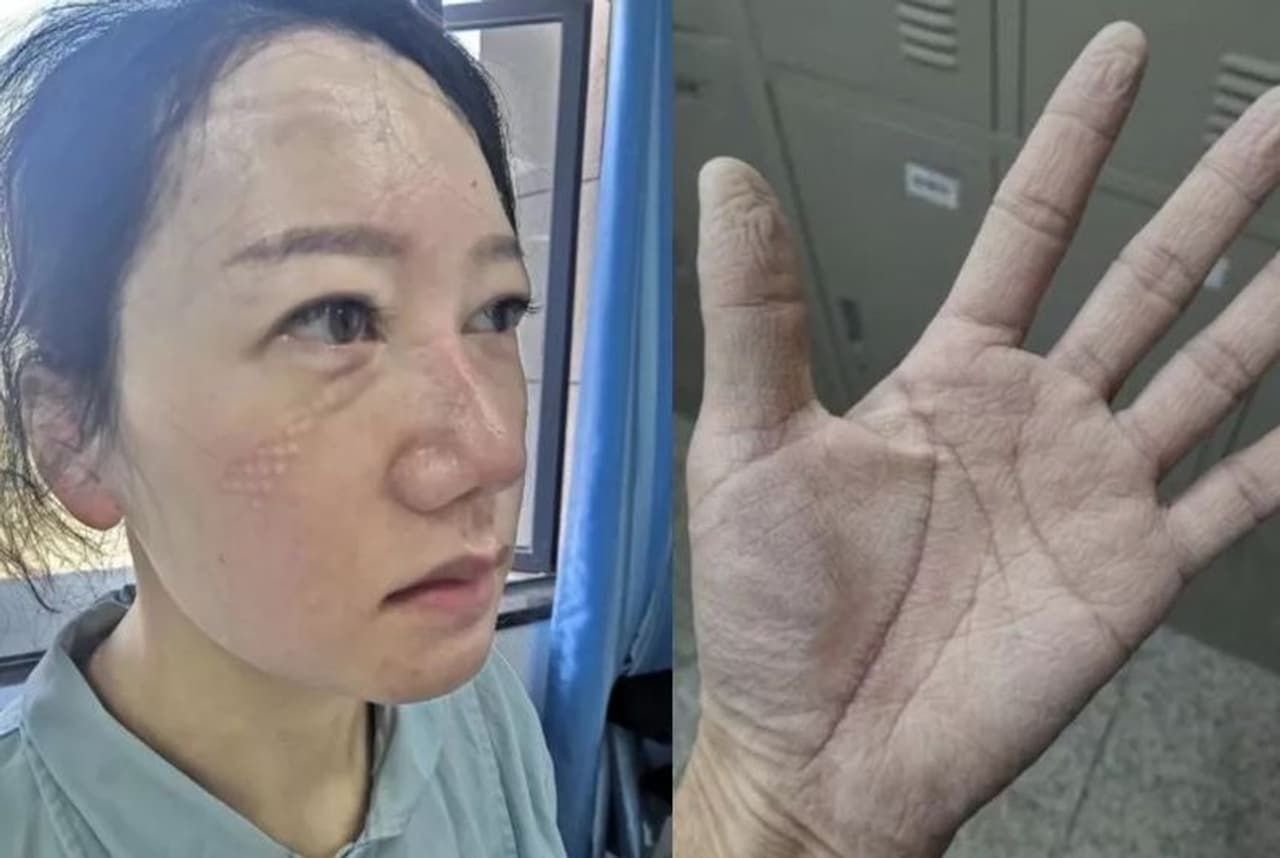 சுயநலமில்லா சேவையில் சீன செவிலியர்கள் சுயநலமில்லா சேவையில் சீன செவிலியர்கள்