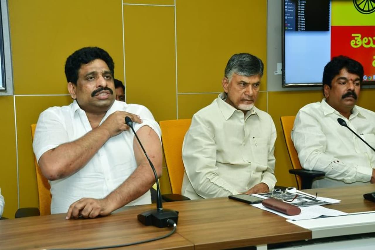 మాచర్ల దాడిలో తగిలిన గాయాలను చూపిస్తున్న బుద్దా వెంకన్న మాచర్ల దాడిలో తగిలిన గాయాలను చూపిస్తున్న బుద్దా వెంకన్న
