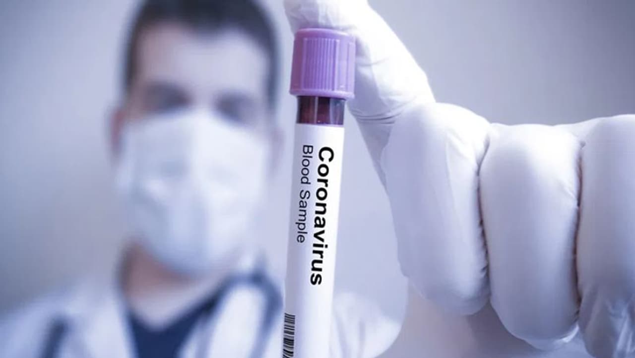 <p>తెలంగాణ రాష్ట్రంపై కరోనా వైరస్ పంజా విసురుతోంది. రోజు రోజుకి కేసులు పెరిగిపోతున్నాయి. కేసులు పెరిగిపోతుండడంతోపాటుగా తెలంగాణలో మరణాల సంఖ్య కూడా విస్తుపోయేలా ఉన్నాయి. భారతదేశ మొత్తంతో పోల్చి చూస్తే తక్కువే అని తెలంగాణ సర్కార్ చెబుతున్నప్పటికీ.... తెలంగాణ సర్కార్ పై ప్రజలు పెట్టుకున్న నమ్మకానికి మాత్రం ఇవి చాలా భయం గొలిపే లెక్కలు. </p> <p>తెలంగాణ రాష్ట్రంపై కరోనా వైరస్ పంజా విసురుతోంది. రోజు రోజుకి కేసులు పెరిగిపోతున్నాయి. కేసులు పెరిగిపోతుండడంతోపాటుగా తెలంగాణలో మరణాల సంఖ్య కూడా విస్తుపోయేలా ఉన్నాయి. భారతదేశ మొత్తంతో పోల్చి చూస్తే తక్కువే అని తెలంగాణ సర్కార్ చెబుతున్నప్పటికీ.... తెలంగాణ సర్కార్ పై ప్రజలు పెట్టుకున్న నమ్మకానికి మాత్రం ఇవి చాలా భయం గొలిపే లెక్కలు. </p>