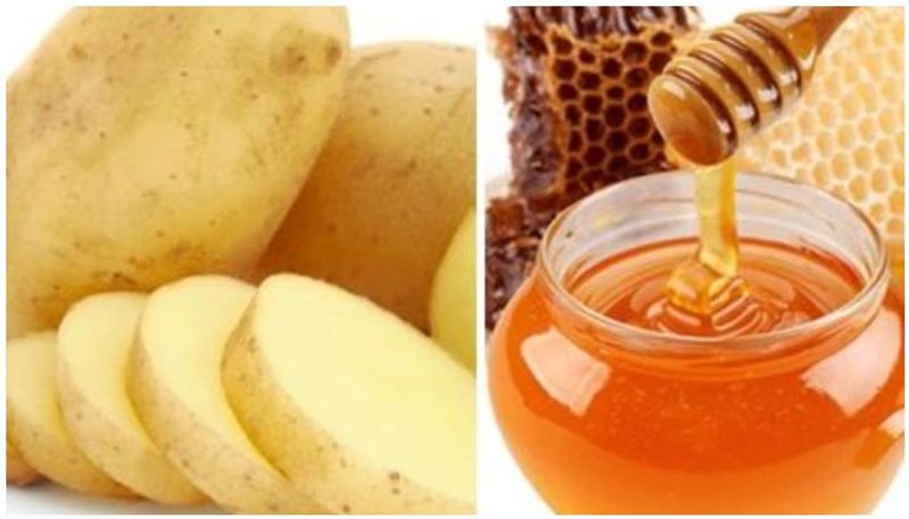 <p><strong>തേനും ഉരുളക്കിഴങ്ങും</strong>:രണ്ട് ടീസ്പൂൺ ഉരുളക്കിഴങ്ങ് ജ്യൂസും രണ്ട് ടീസ്പൂൺ തേനും ചേർത്ത് നല്ല പോലെ മിശ്രിതമാക്കുക. ശേഷം 15 മിനിറ്റ് മുഖത്തിടുക. ഉണങ്ങി കഴിഞ്ഞാൽ തണുത്ത വെള്ളത്തിൽ കഴുകി കളയുക. ആഴ്ചയിൽ രണ്ടോ മൂന്നോ തവണ ഇത് ഉപയോഗിക്കാവുന്നതാണ്. മുഖത്തെ ചുളിവുകൾ മാറാൻ മികച്ചൊരു പാക്കാണ് ഇത്. </p> <p><strong>തേനും ഉരുളക്കിഴങ്ങും</strong>:രണ്ട് ടീസ്പൂൺ ഉരുളക്കിഴങ്ങ് ജ്യൂസും രണ്ട് ടീസ്പൂൺ തേനും ചേർത്ത് നല്ല പോലെ മിശ്രിതമാക്കുക. ശേഷം 15 മിനിറ്റ് മുഖത്തിടുക. ഉണങ്ങി കഴിഞ്ഞാൽ തണുത്ത വെള്ളത്തിൽ കഴുകി കളയുക. ആഴ്ചയിൽ രണ്ടോ മൂന്നോ തവണ ഇത് ഉപയോഗിക്കാവുന്നതാണ്. മുഖത്തെ ചുളിവുകൾ മാറാൻ മികച്ചൊരു പാക്കാണ് ഇത്. </p>