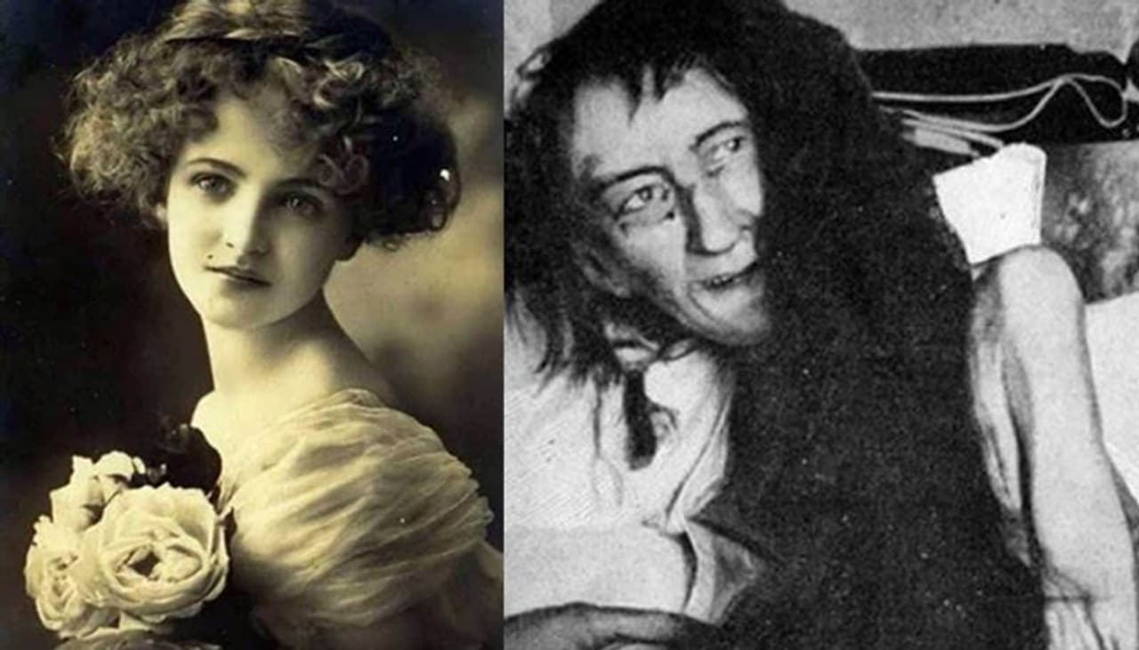 <p>1849 മാര്ച്ച് ഒന്നിനാണ് ബ്ലഞ്ച് ജനിച്ചത്. അവളുടെ പ്രഭ്വിയായ അമ്മ അവളെ ഒരു കുഞ്ഞു മുറിക്കുള്ളില് ചങ്ങലക്കിട്ടത് 25 വര്ഷം. ഒടുവില് പൊലീസ് കണ്ടെത്തുമ്പോഴേക്കും എല്ലും തോലും മാത്രമായിക്കഴിഞ്ഞിരുന്നു അവള്... അവളുടെ യൗവ്വനമെല്ലാം ആ ഇരുട്ടുമുറി കവര്ന്നെടുത്തിരുന്നു. ആ 25 വര്ഷത്തിനിടയില് ഒരിക്കല് പോലും അവള് സൂര്യപ്രകാശം കണ്ടിരുന്നില്ലെന്നാണ് പറയുന്നത്. </p> <p>1849 മാര്ച്ച് ഒന്നിനാണ് ബ്ലഞ്ച് ജനിച്ചത്. അവളുടെ പ്രഭ്വിയായ അമ്മ അവളെ ഒരു കുഞ്ഞു മുറിക്കുള്ളില് ചങ്ങലക്കിട്ടത് 25 വര്ഷം. ഒടുവില് പൊലീസ് കണ്ടെത്തുമ്പോഴേക്കും എല്ലും തോലും മാത്രമായിക്കഴിഞ്ഞിരുന്നു അവള്... അവളുടെ യൗവ്വനമെല്ലാം ആ ഇരുട്ടുമുറി കവര്ന്നെടുത്തിരുന്നു. ആ 25 വര്ഷത്തിനിടയില് ഒരിക്കല് പോലും അവള് സൂര്യപ്രകാശം കണ്ടിരുന്നില്ലെന്നാണ് പറയുന്നത്. </p>