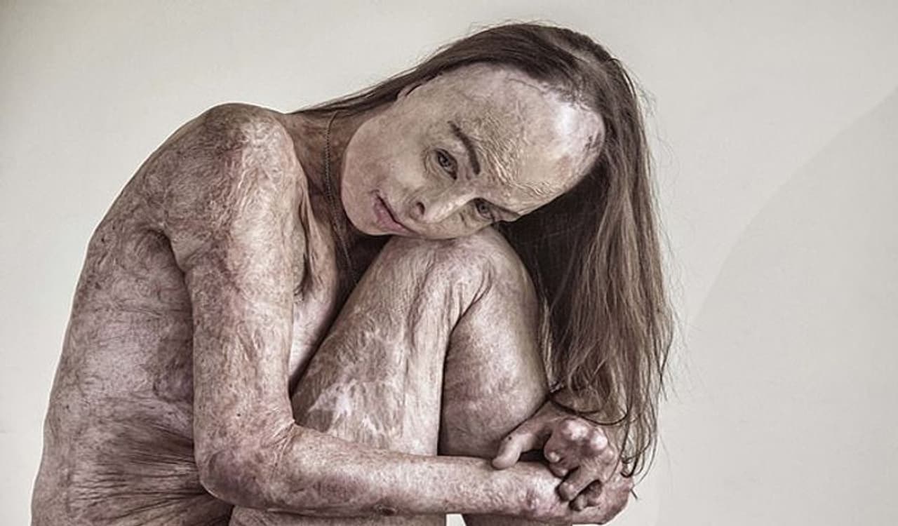 <p>53 ವರ್ಷದ ಕೈರೋಲ್ ಮೇಯರ್ ಆಸ್ಟ್ರೇಲಿಯಾ ನಿವಾಸಿ. ಇವರು ನಗ್ನ ಫೋಟೋಗಳನ್ನು ಲಂಡನ್‌ನ ಫೋಟೋಗ್ರಾಫರ್ ಬ್ರಾಯನ್ ಎಂಬವರು ಕ್ಲಿಕ್ಕಿಸಿದ್ದಾರೆ. ಈ ಫೋಟೋಗಳನ್ನು Portrait of Humanity 2020 ಅವಾರ್ಡ್‌ಗೆ ಆಯ್ಕೆ ಮಾಡಲಾಗಿದೆ.</p>