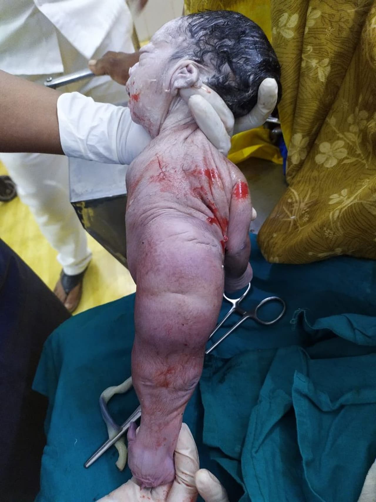 <p>ಗರ್ಭಿಣಿ ಇದ್ದ ಸಂದರ್ಭದಲ್ಲಿ ಪ್ರತಿ ತಿಂಗಳು ಆಸ್ಪತ್ರೆಯಲ್ಲಿ ಪರೀಕ್ಷೆ ಮಾಡಿಸಿಕೊಳ್ಳುತ್ತಿದ್ದ ಮಹಿಳೆ&nbsp;</p>