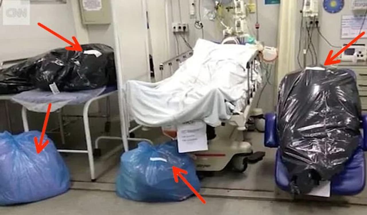 <p>ಬ್ರೆಜಿಲ್‌ನಲ್ಲಿ &nbsp;ಕೊರೋನಾ ಸೃಷ್ಟಿಸಿರುವ ಅನಾಹುತವನ್ನು ಕೆಲ ಫೋಟೋಗಳು ಸೋಶಿಯಲ್ ಮಿಡಿಯಾದಲ್ಲಿ ಬಹಿರಂಗಪಡಿಸಿವೆ. ಇಲ್ಲಿ ಸೋಂಕಿತರ ಶವವನ್ನು ಕಸ ತುಂಬಿಸಿಡುವ ಬ್ಯಾಗ್‌ನಲ್ಲಿ ಹಾಕಲಾಗುತ್ತಿದೆ. ಅಲ್ಲದೇ ಇದನ್ನು ರೋಗಿಗಳ ಬಳಿಯೇ ಇರಿಸಲಾಗುತ್ತಿದೆ. ಈ ಫೋಟೋ ರಿಯೋ ದಿ ಜೆನಿರಿಯೋದ್ದಾಗಿದೆ.&nbsp;</p>