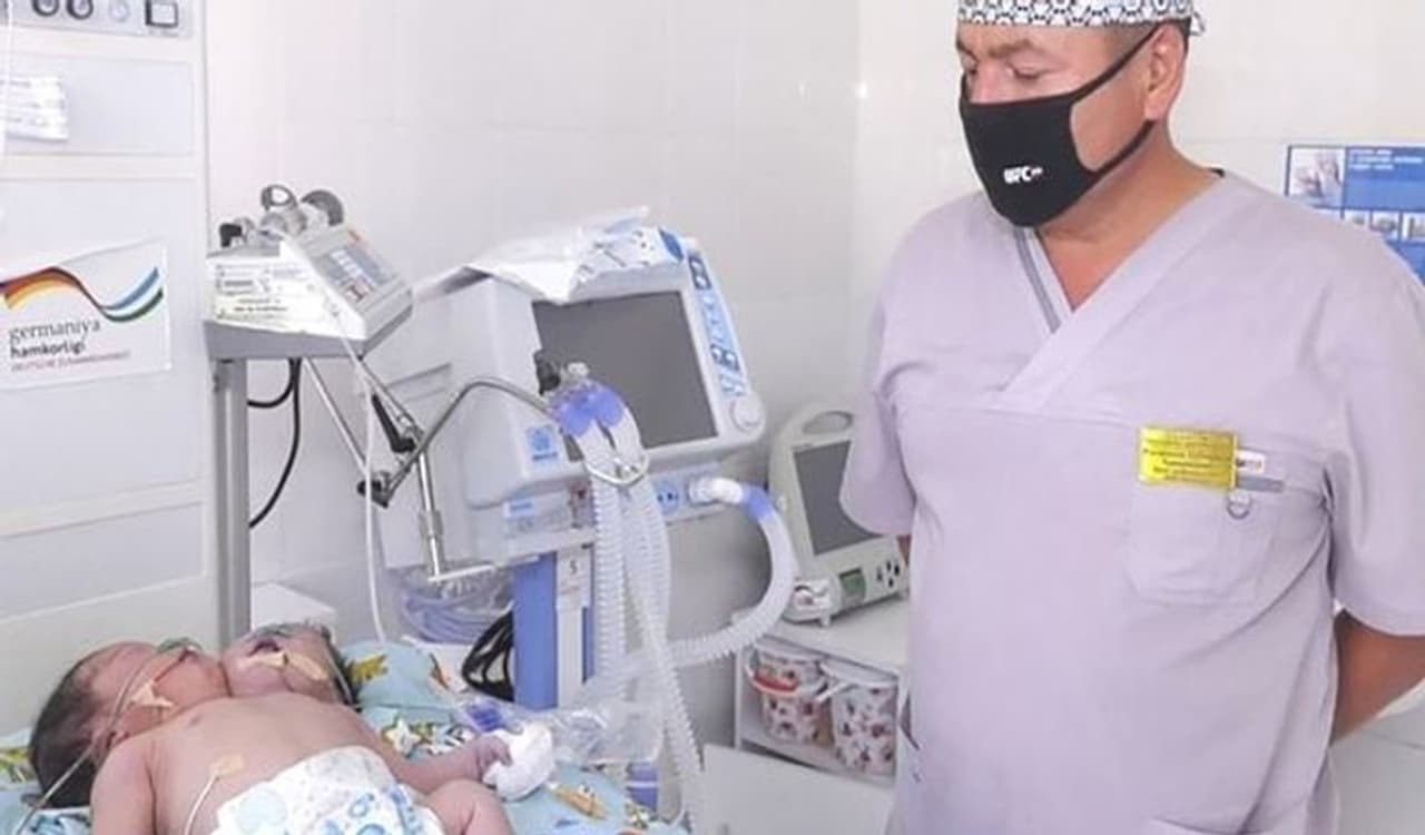 <p>ಈ ಘಟನೆ ನಡೆದದ್ದು ಉಜ್ಬೇಕಿಸ್ತಾನದಲ್ಲಿ. ಇಲ್ಲಿ ಎರಡು ತಲೆಯ ಮಗು ಜನಿಸಿದ್ದು, ಐಸಿಯುನಲ್ಲಿ ಮಗು ಜೀವನ್ಮರಣ ಸ್ಥಿತಿಯಲ್ಲಿ ಹೋರಾಡುತ್ತಿದೆ.</p> <p>ಈ ಘಟನೆ ನಡೆದದ್ದು ಉಜ್ಬೇಕಿಸ್ತಾನದಲ್ಲಿ. ಇಲ್ಲಿ ಎರಡು ತಲೆಯ ಮಗು ಜನಿಸಿದ್ದು, ಐಸಿಯುನಲ್ಲಿ ಮಗು ಜೀವನ್ಮರಣ ಸ್ಥಿತಿಯಲ್ಲಿ ಹೋರಾಡುತ್ತಿದೆ.</p>