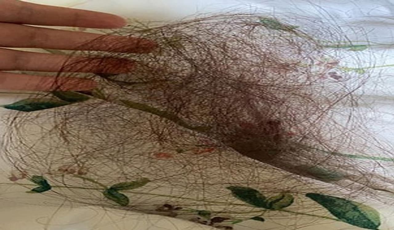 <p>ದೇಹದ ಕೂದಲು ಹೊಂದುವುದು ಸಾಮಾನ್ಯ, ಮತ್ತು ನಮ್ಮಲ್ಲಿ ಹೆಚ್ಚಿನವರು ಅವುಗಳನ್ನು ಕಂಡ ತಕ್ಷಣ ತೆಗೆಯಲು ಪ್ರಯತ್ನಿಸುತ್ತಾರೆ. ಮಾನವ ದೇಹದ ಮೇಲೆ ಸುಮಾರು 5 ಮಿಲಿಯನ್ ಕೂದಲಿನ ಕಿರುಚೀಲಗಳಿವೆ ಎಂದು ತಿಳಿದಿದೆಯೇ? ಇದು ಆಕರ್ಷಣೆಗೆ ಒಳಗಾಗಿಸಬಹುದಾದರೂ, ದೇಹದ ಕೂದಲು ಒಟ್ಟಾರೆ ಆರೋಗ್ಯ ಮತ್ತು ಯೋಗಕ್ಷೇಮದ ಬಗ್ಗೆ ಮಾಹಿತಿ ನೀಡಬಲ್ಲದು.</p> <p>ದೇಹದ ಕೂದಲು ಹೊಂದುವುದು ಸಾಮಾನ್ಯ, ಮತ್ತು ನಮ್ಮಲ್ಲಿ ಹೆಚ್ಚಿನವರು ಅವುಗಳನ್ನು ಕಂಡ ತಕ್ಷಣ ತೆಗೆಯಲು ಪ್ರಯತ್ನಿಸುತ್ತಾರೆ. ಮಾನವ ದೇಹದ ಮೇಲೆ ಸುಮಾರು 5 ಮಿಲಿಯನ್ ಕೂದಲಿನ ಕಿರುಚೀಲಗಳಿವೆ ಎಂದು ತಿಳಿದಿದೆಯೇ? ಇದು ಆಕರ್ಷಣೆಗೆ ಒಳಗಾಗಿಸಬಹುದಾದರೂ, ದೇಹದ ಕೂದಲು ಒಟ್ಟಾರೆ ಆರೋಗ್ಯ ಮತ್ತು ಯೋಗಕ್ಷೇಮದ ಬಗ್ಗೆ ಮಾಹಿತಿ ನೀಡಬಲ್ಲದು.</p>