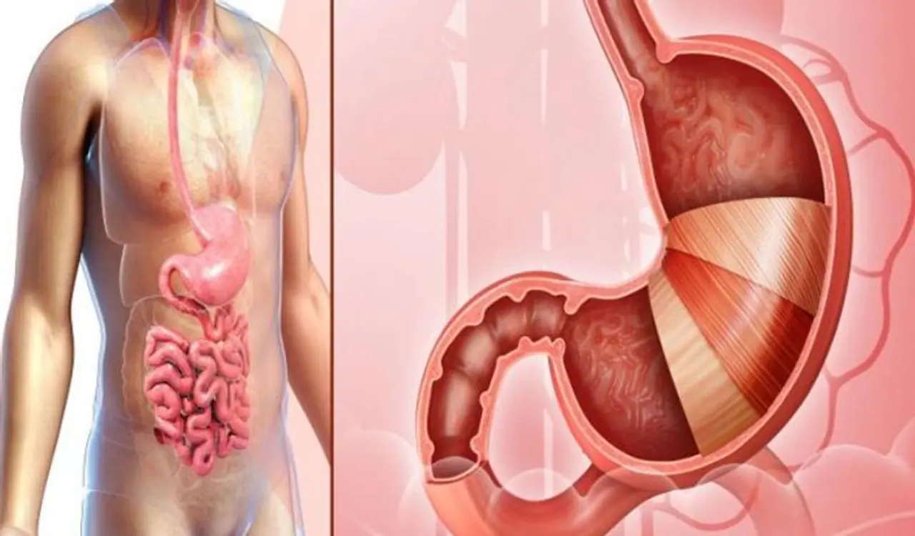 <p>ಹಿಂದಿನ ಕಾಲದಲ್ಲಿ ಅಜ್ಜಿಯರ ಸಂಪ್ರದಾಯದ ಸೌಂದರ್ಯವೆಂದರೆ ಅದು ಅಡುಗೆ ಮನೆಯಲ್ಲಿ ಕಂಡುಬರುವ ಸರಳವಾದ ಪದಾರ್ಥಗಳು. ಅವುಗಳನ್ನು ಬಳಸಿಕೊಂಡೆ ಹಿಂದೆ ಜನರು ಪರಿಣಾಮಕಾರಿ ಪರಿಹಾರಗಳನ್ನು ಪಡೆಯುತ್ತಿದ್ದರು. ಕರುಳಿನ ಆರೋಗ್ಯದ ಸಮಸ್ಯೆ ಬಂದರೂ ಸಹ ಸುಲಭವಾಗಿ ಮನೆಯಲ್ಲಿಯೇ ಮದ್ದು ಮಾಡುತ್ತಿದ್ದರು. ಅಂತಹ ಒಂದು ಆಹಾರ ಕ್ರಮ ಒಣದ್ರಾಕ್ಷಿಗಳೊಂದಿಗೆ ಮೊಸರು ಸೇವಿಸುವುದು.</p>