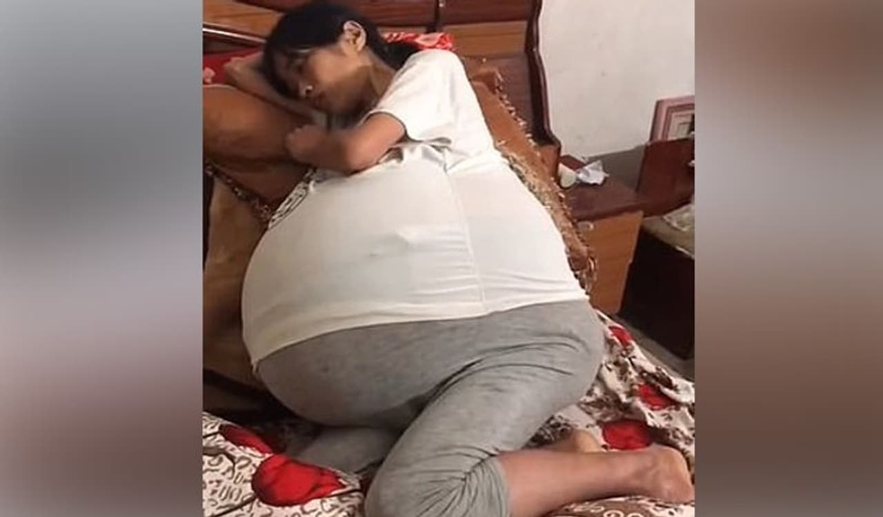 <p><br />ఈ ఫోటోలో కనిపిస్తున్న మహిళను చూశారా..? కడుపుతో ఉందేమో అని అనుకుంటున్నారు కదా. కానీ ఆమె గర్భవతి కాదు.. కానీ.. రోజు రోజుకీ ఆమె పొట్ట అమాంతం పెరిగిపోతోంది. ఈ సంఘటన చైనాలో చోటుచేసుకోగా.. పూర్తి వివరాలు ఇలా ఉన్నాయి.</p> <p><br />ఈ ఫోటోలో కనిపిస్తున్న మహిళను చూశారా..? కడుపుతో ఉందేమో అని అనుకుంటున్నారు కదా. కానీ ఆమె గర్భవతి కాదు.. కానీ.. రోజు రోజుకీ ఆమె పొట్ట అమాంతం పెరిగిపోతోంది. ఈ సంఘటన చైనాలో చోటుచేసుకోగా.. పూర్తి వివరాలు ఇలా ఉన్నాయి.</p>