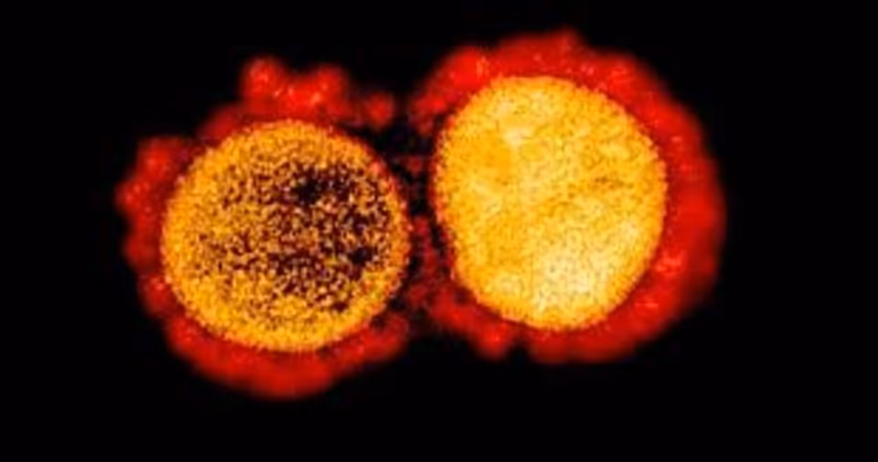 <p> Malaysia has detected a strain of the coronavirus, which is 10 times deadlier</p> <p> Malaysia has detected a strain of the coronavirus, which is 10 times deadlier</p>