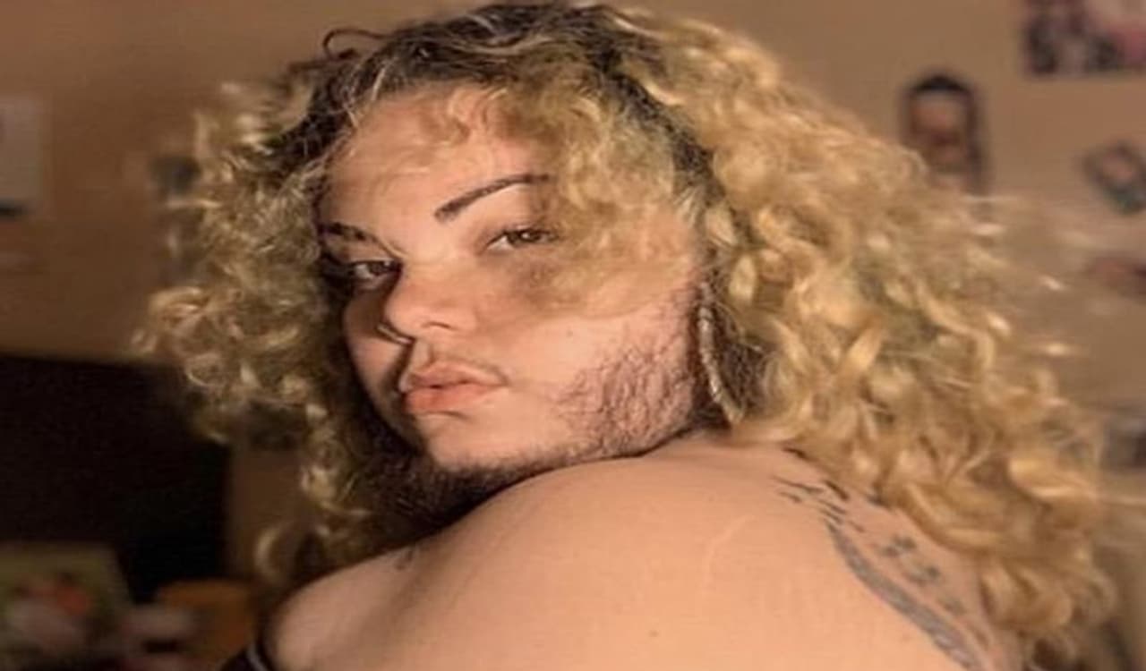 <p>ಪಿಸಿಓಎಸ್ ಎಂಬುದು ಹಾರ್ಮೋನುಗಳಿಂದಾಗಿ ಉಂಟಾಗುವ ಸಮಸ್ಯೆಯಾಗಿ ಹದಿಹರೆಯದವರು, ಚಿಕ್ಕ ವಯಸ್ಸಿನವರಲ್ಲಿಯೂ ಕಾಣಿಸಿಕೊಳ್ಳುತ್ತದೆ. ಈ ಸಮಯದಲ್ಲಿ, ಮಹಿಳೆಯ ದೇಹದಲ್ಲಿ ಅನೇಕ ವಿಚಿತ್ರ ಬದಲಾವಣೆಗಳಾಗುತ್ತವೆ. ದೇಹದ ಅನೇಕ ಭಾಗಗಳಲ್ಲಿ ಅನಗತ್ಯ ಕೂದಲು ಬೆಳೆಯುವುದು, ದೇಹದ ತೂಕವೂ ಹೆಚ್ಚುತ್ತದೆ. </p> <p>ಪಿಸಿಓಎಸ್ ಎಂಬುದು ಹಾರ್ಮೋನುಗಳಿಂದಾಗಿ ಉಂಟಾಗುವ ಸಮಸ್ಯೆಯಾಗಿ ಹದಿಹರೆಯದವರು, ಚಿಕ್ಕ ವಯಸ್ಸಿನವರಲ್ಲಿಯೂ ಕಾಣಿಸಿಕೊಳ್ಳುತ್ತದೆ. ಈ ಸಮಯದಲ್ಲಿ, ಮಹಿಳೆಯ ದೇಹದಲ್ಲಿ ಅನೇಕ ವಿಚಿತ್ರ ಬದಲಾವಣೆಗಳಾಗುತ್ತವೆ. ದೇಹದ ಅನೇಕ ಭಾಗಗಳಲ್ಲಿ ಅನಗತ್ಯ ಕೂದಲು ಬೆಳೆಯುವುದು, ದೇಹದ ತೂಕವೂ ಹೆಚ್ಚುತ್ತದೆ. </p>