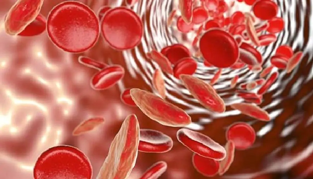 <p><strong>ಇವು ರಕ್ತಹೀನತೆಯ ಲಕ್ಷಣಗಳು</strong><br />ದೌರ್ಬಲ್ಯ <br />ಉಸಿರಾಟದ ತೊಂದರೆ <br />ತಲೆನೋವು <br />ಮನಸ್ಸುಗಳ ವೇಗದ ಚಲನೆ (ಮೂಡ್ ಸ್ವಿಂಗ್)<br />ಪ್ರತಿ ಬಾರಿಯೂ ಕೈ ಕಾಲುಗಳು ತಂಪಾಗುವುದು </p> <p><strong>ಇವು ರಕ್ತಹೀನತೆಯ ಲಕ್ಷಣಗಳು</strong><br />ದೌರ್ಬಲ್ಯ <br />ಉಸಿರಾಟದ ತೊಂದರೆ <br />ತಲೆನೋವು <br />ಮನಸ್ಸುಗಳ ವೇಗದ ಚಲನೆ (ಮೂಡ್ ಸ್ವಿಂಗ್)<br />ಪ್ರತಿ ಬಾರಿಯೂ ಕೈ ಕಾಲುಗಳು ತಂಪಾಗುವುದು </p>