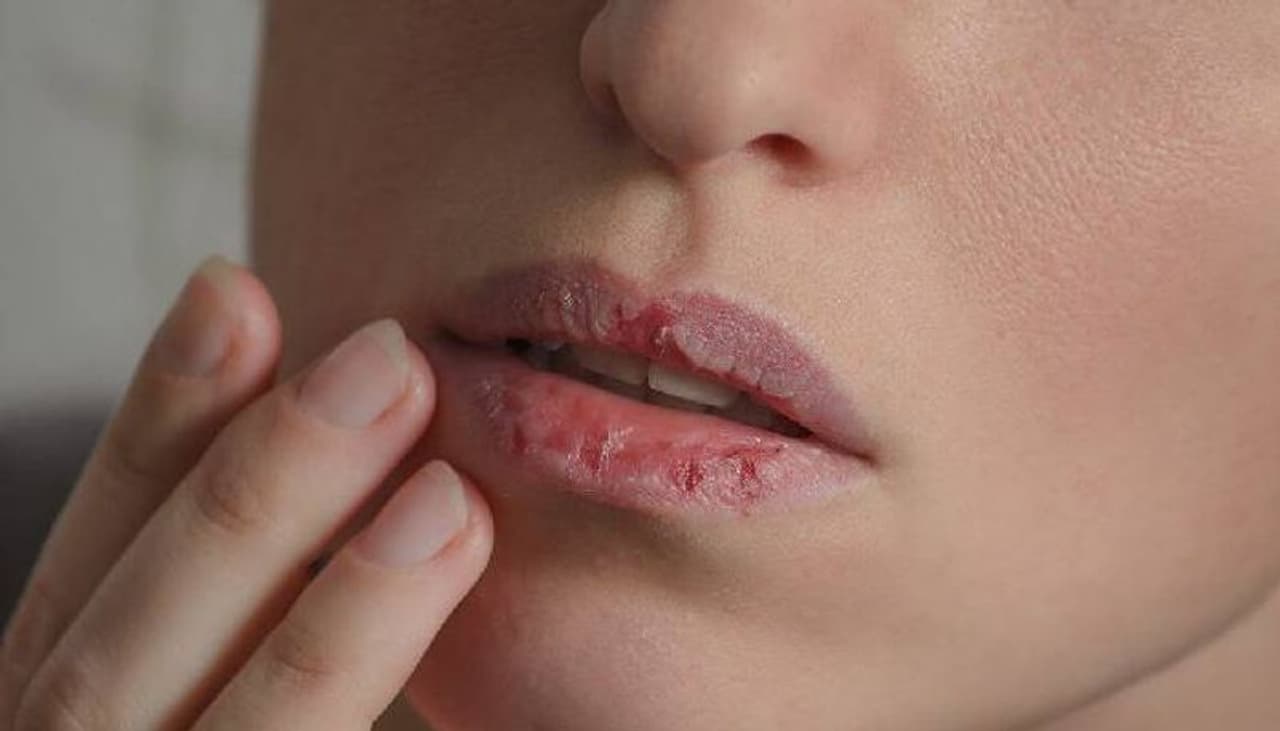 <p style="text align: justify;">ನೀವು ಮನೆಯಲ್ಲಿ ಮಾಡಬಹುದಾದ 3 ಬಗೆಯ ಲಿಪ್ ಬಾಮ್ ಗಳು</p><p style="text align: justify;">ಪರಿಪೂರ್ಣ ತುಟಿಗಳನ್ನು ಹೊಂದಿರುವ ಟಿವಿ ಜಾಹಿರಾತುಗಳು ಅಸೂಯೆಪಡಿಸುವುದೇ? ನಾವು ನಿಮ್ಮನ್ನು ದೂಷಿಸುವುದಿಲ್ಲ. ಪ್ರತಿಯೊಬ್ಬರೂ ತಮ್ಮ ತುಟಿಗಳು ಮೃದುವಾಗಿ ಮತ್ತು ಕೋಮಲವಾಗಿರಬೇಕು ಎಂದು ಬಯಸುತ್ತಾರೆ ಮತ್ತು ಅವರಿಗೆ ಸೂಕ್ತವಾದ ಪೋಷಣೆಯನ್ನು ನೀಡುವ ಮೂಲಕ ನೀವು ಸುಂದರ ತುಟಿಗಳನ್ನು ಪಡೆಯಬಹುದು. ನಿಯಮಿತವಾಗಿ ಹಲ್ಲುಜ್ಜುವುದು ಒಂದೇ ವಿಷಯ ಎಂದು ಹಲವರು ಭಾವಿಸುತ್ತಾರೆ, ಇದು ಮೌಖಿಕ ನೈರ್ಮಲ್ಯದ ಒಂದು ಭಾಗವಾಗಿದೆ, ಆದರೆ ಇದು ನಿಜವಲ್ಲ. ನಮ್ಮ ತುಟಿಗಳನ್ನು ಆರೋಗ್ಯಕರವಾಗಿ ಮತ್ತು ಆರ್ಧ್ರಕವಾಗಿಸುವುದು ಸಹ ಬಹಳ ಮುಖ್ಯ. </p> <p style="text align: justify;">ನೀವು ಮನೆಯಲ್ಲಿ ಮಾಡಬಹುದಾದ 3 ಬಗೆಯ ಲಿಪ್ ಬಾಮ್ ಗಳು</p><p style="text align: justify;">ಪರಿಪೂರ್ಣ ತುಟಿಗಳನ್ನು ಹೊಂದಿರುವ ಟಿವಿ ಜಾಹಿರಾತುಗಳು ಅಸೂಯೆಪಡಿಸುವುದೇ? ನಾವು ನಿಮ್ಮನ್ನು ದೂಷಿಸುವುದಿಲ್ಲ. ಪ್ರತಿಯೊಬ್ಬರೂ ತಮ್ಮ ತುಟಿಗಳು ಮೃದುವಾಗಿ ಮತ್ತು ಕೋಮಲವಾಗಿರಬೇಕು ಎಂದು ಬಯಸುತ್ತಾರೆ ಮತ್ತು ಅವರಿಗೆ ಸೂಕ್ತವಾದ ಪೋಷಣೆಯನ್ನು ನೀಡುವ ಮೂಲಕ ನೀವು ಸುಂದರ ತುಟಿಗಳನ್ನು ಪಡೆಯಬಹುದು. ನಿಯಮಿತವಾಗಿ ಹಲ್ಲುಜ್ಜುವುದು ಒಂದೇ ವಿಷಯ ಎಂದು ಹಲವರು ಭಾವಿಸುತ್ತಾರೆ, ಇದು ಮೌಖಿಕ ನೈರ್ಮಲ್ಯದ ಒಂದು ಭಾಗವಾಗಿದೆ, ಆದರೆ ಇದು ನಿಜವಲ್ಲ. ನಮ್ಮ ತುಟಿಗಳನ್ನು ಆರೋಗ್ಯಕರವಾಗಿ ಮತ್ತು ಆರ್ಧ್ರಕವಾಗಿಸುವುದು ಸಹ ಬಹಳ ಮುಖ್ಯ. </p>