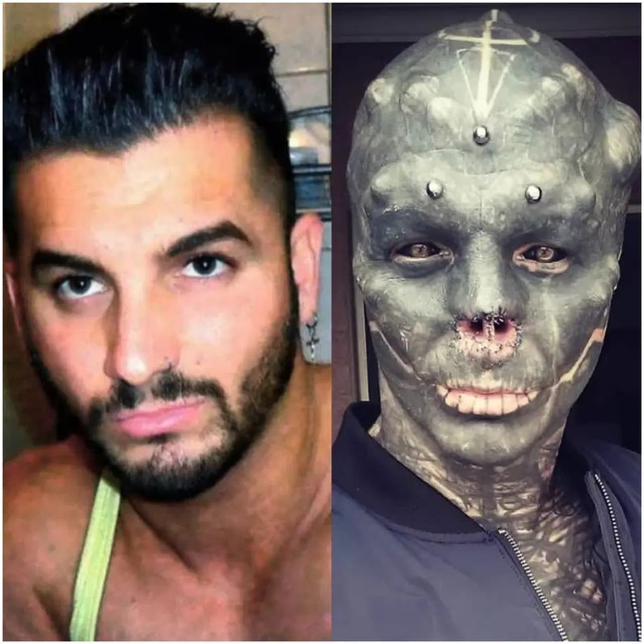 <p>'കറുത്ത അന്യഗ്രഹജീവി' ആകണമെന്ന ആഗ്രഹത്തില് ഫ്രഞ്ചുകാരനായ ആന്റോണിയോ ലോഫ്രേഡോ തന്റെ മൂക്ക് ശസ്ത്രക്രിയയിലൂടെ ഈ ആഴ്ച നീക്കം ചെയ്തു.<br /> </p> <p>'കറുത്ത അന്യഗ്രഹജീവി' ആകണമെന്ന ആഗ്രഹത്തില് ഫ്രഞ്ചുകാരനായ ആന്റോണിയോ ലോഫ്രേഡോ തന്റെ മൂക്ക് ശസ്ത്രക്രിയയിലൂടെ ഈ ആഴ്ച നീക്കം ചെയ്തു.<br /> </p>