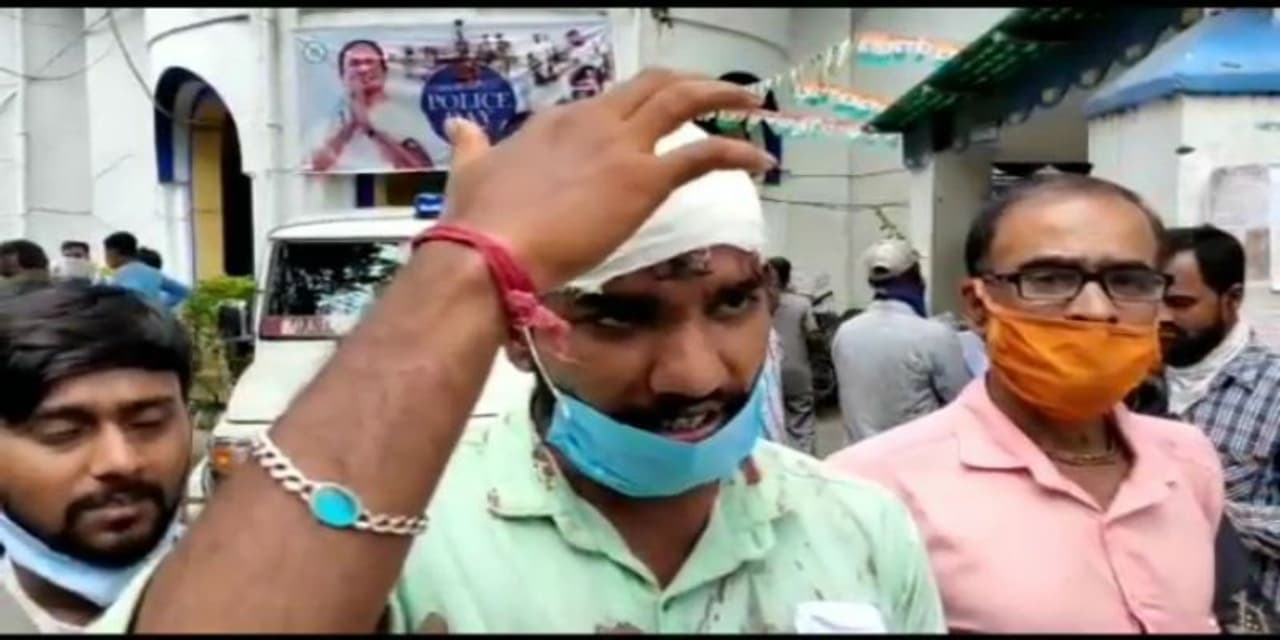 <p>A BJP booth president was attacked by a group of miscreants. His head was severely injured in the attack. Locals rescued him and he was admitted to Burdwan Medical College Hospital.<br /> </p> <p>A BJP booth president was attacked by a group of miscreants. His head was severely injured in the attack. Locals rescued him and he was admitted to Burdwan Medical College Hospital.<br /> </p>