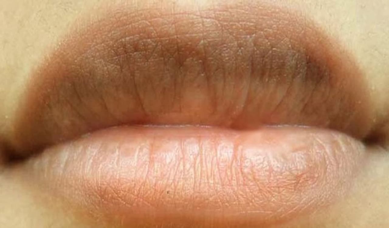<p style="text align: justify;">Lips need the utmost care, and there are many reasons why our lips can get pigmented and dark patches. If you are a smoker or a caffeine lover, you will get dark pigmented lips. Here are some quick and easy fixes to get rosy soft lips.</p>