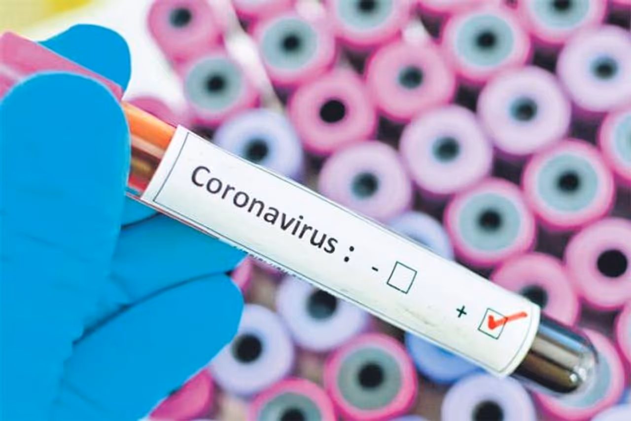 <p>India's Covid 19 caseload rose to 1,01,23,778 with 24,712 new infections being reported in a day, while the recoveries have surged to 96.93 lakh, according to the Union health ministry data updated on Thursday.</p> <p>India's Covid 19 caseload rose to 1,01,23,778 with 24,712 new infections being reported in a day, while the recoveries have surged to 96.93 lakh, according to the Union health ministry data updated on Thursday.</p>