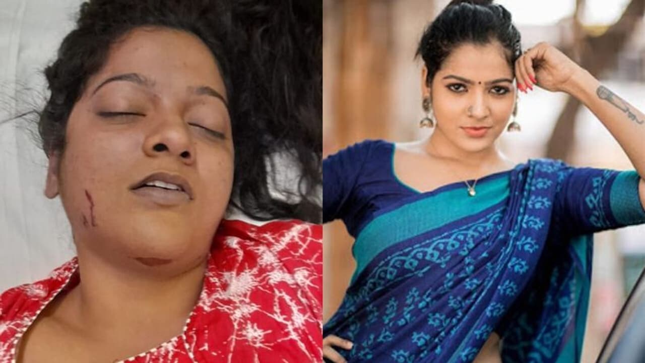 <p>பாண்டியன் ஸ்டோர்ஸ் சீரியலில் முல்லை கதாபாத்திரத்தில் நடித்ததன் மூலமாக ரசிகர்களின் உள்ளத்தை கொள்ளைக் கொண்ட விஜே சித்ரா, கடந்த 9ம் தேதி பூந்தமல்லியில் உள்ள நட்சத்திர ஓட்டலில் தூக்கிட்டு தற்கொலை செய்து கொண்டார். <br /> </p> <p>பாண்டியன் ஸ்டோர்ஸ் சீரியலில் முல்லை கதாபாத்திரத்தில் நடித்ததன் மூலமாக ரசிகர்களின் உள்ளத்தை கொள்ளைக் கொண்ட விஜே சித்ரா, கடந்த 9ம் தேதி பூந்தமல்லியில் உள்ள நட்சத்திர ஓட்டலில் தூக்கிட்டு தற்கொலை செய்து கொண்டார். <br /> </p>