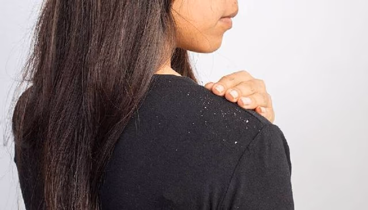 <p style="text align: justify;">Other than enhancing the taste of your meals, red onions have many beneficiaries. It is rich in sulphur, anti bacterial, and anti fungal properties, giving strength and nutrition to your hair.&nbsp;</p>