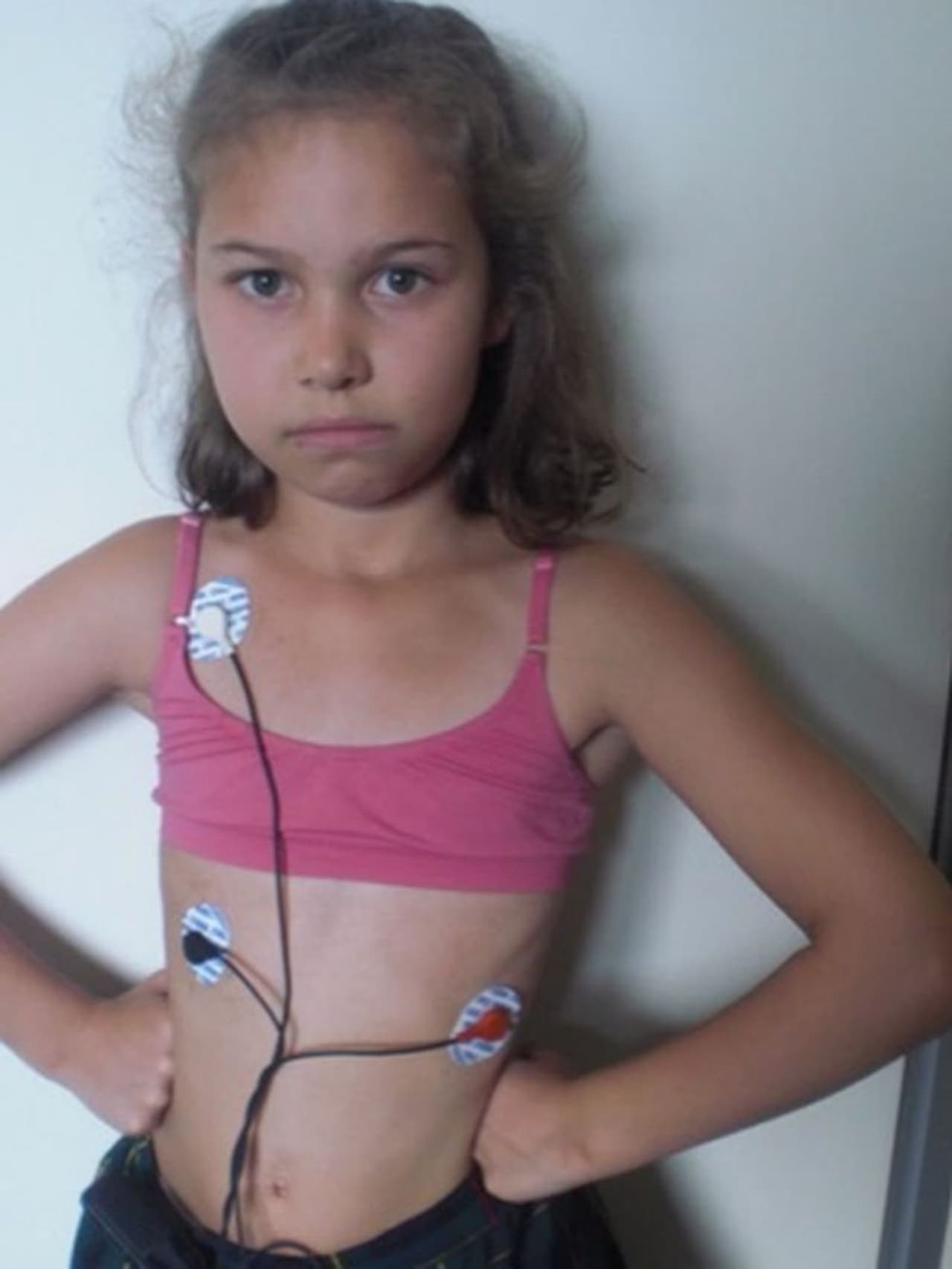 <p>മറ്റെല്ലാ കുട്ടികളെയും പോലെ ഒൻപത് വയസ്സുവരെ അവൾ തീർത്തും സന്തോഷവതിയായിരുന്നു. കൂട്ടുകാരുടെ കൂടെ കളിച്ചും, പഠിച്ചും അവൾ വളർന്നു. എന്നാൽ 2010 മുതൽ ആരോഗ്യ പ്രശ്നങ്ങൾ അവളെ അലട്ടാൻ തുടങ്ങി. അവൾക്ക് നിരന്തരം മൂക്കൊലിപ്പും തലവേദനയും അനുഭവപ്പെടാൻ തുടങ്ങി. </p> <p>മറ്റെല്ലാ കുട്ടികളെയും പോലെ ഒൻപത് വയസ്സുവരെ അവൾ തീർത്തും സന്തോഷവതിയായിരുന്നു. കൂട്ടുകാരുടെ കൂടെ കളിച്ചും, പഠിച്ചും അവൾ വളർന്നു. എന്നാൽ 2010 മുതൽ ആരോഗ്യ പ്രശ്നങ്ങൾ അവളെ അലട്ടാൻ തുടങ്ങി. അവൾക്ക് നിരന്തരം മൂക്കൊലിപ്പും തലവേദനയും അനുഭവപ്പെടാൻ തുടങ്ങി. </p>