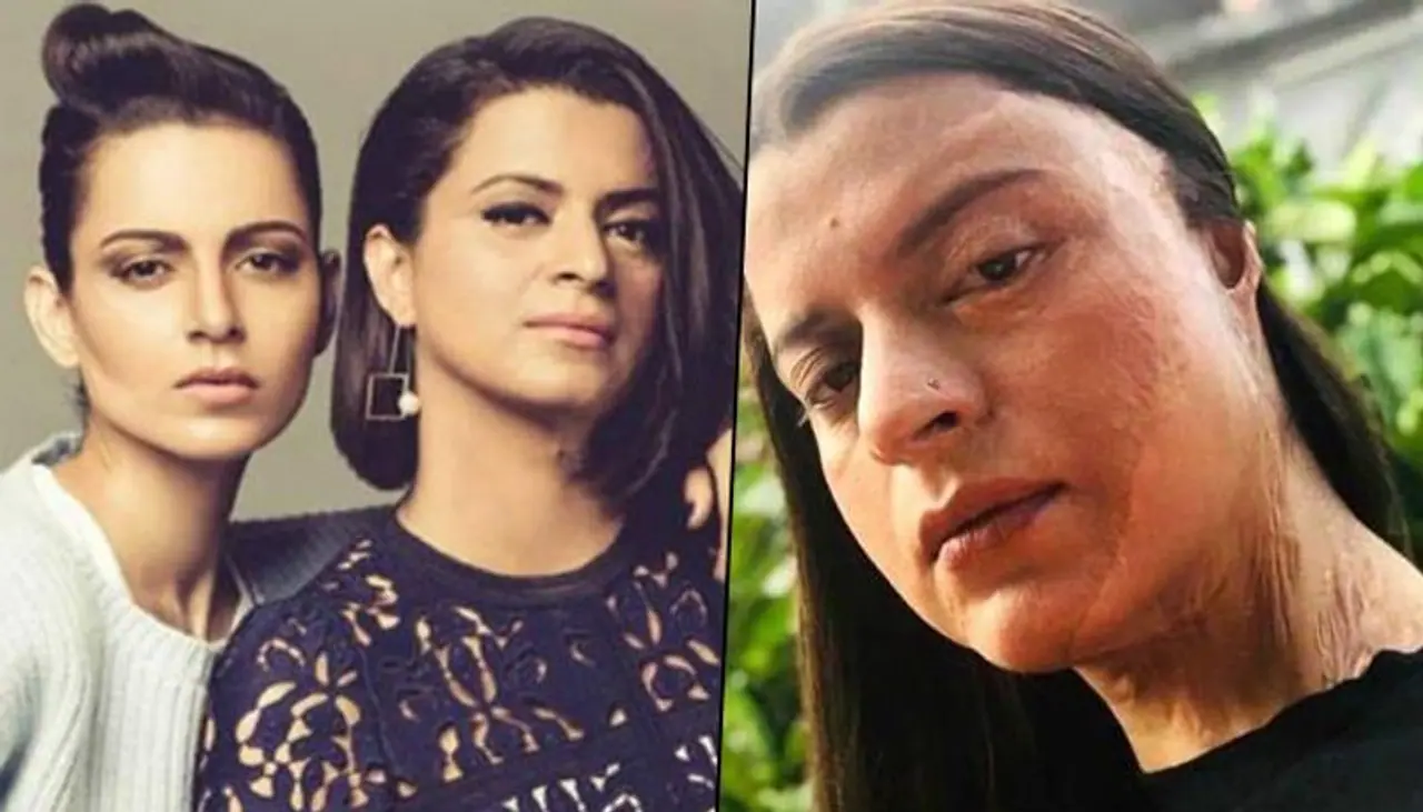 <p>Kangana Ranaut's other name is has become synonymous with controversies, from her Hrithik Roshan's alleged affair to picking up fight with Bollywood's biggies like Karan Johar, Salman Khan to speak her voice against Maharashtra current government. </p> <p>Kangana Ranaut's other name is has become synonymous with controversies, from her Hrithik Roshan's alleged affair to picking up fight with Bollywood's biggies like Karan Johar, Salman Khan to speak her voice against Maharashtra current government. </p>