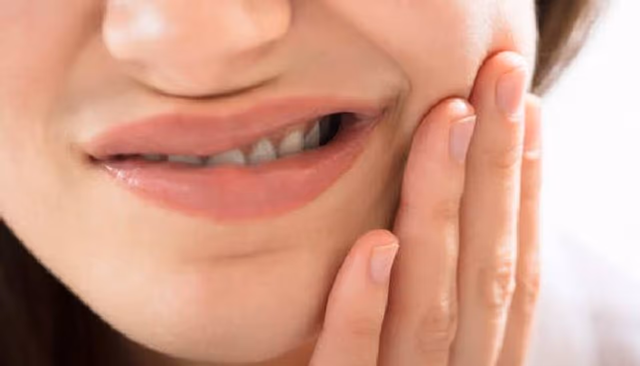 <p><strong>ವಿಸ್ಡಮ್ ಹಲ್ಲು ನೋವಿಗೆ ಕಾರಣಗಳೇನು?</strong><br />ವಿಸ್ಡಮ್ ಹಲ್ಲು ನೋವು ಮುಖ್ಯವಾಗಿ ಹಲ್ಲಿನ ಉಗಮದಿಂದ ಉಂಟಾಗುತ್ತದೆ. ಇದು ಒಸಡುಗಳ ಗೆರೆಯ ಮೂಲಕ ಒಡೆದು ಉರಿಯೂತ, ಕೆಂಪಾಗುವಿಕೆ ಮತ್ತು ಊತಕ್ಕೆ ಕಾರಣವಾಗಬಹುದು, ಇದು ತುಂಬಾ ನೋವಿನಿಂದ ಕೂಡಿರಬಹುದು. ಬಾಧಿತ ಪ್ರದೇಶದಲ್ಲಿ ರಕ್ತಸ್ರಾವವಾಗಬಹುದು, ಮತ್ತು ತಲೆನೋವುಗಳ ಪ್ರಸಂಗಗಳನ್ನು ಅನುಭವಿಸಬಹುದು.</p> <p><strong>ವಿಸ್ಡಮ್ ಹಲ್ಲು ನೋವಿಗೆ ಕಾರಣಗಳೇನು?</strong><br />ವಿಸ್ಡಮ್ ಹಲ್ಲು ನೋವು ಮುಖ್ಯವಾಗಿ ಹಲ್ಲಿನ ಉಗಮದಿಂದ ಉಂಟಾಗುತ್ತದೆ. ಇದು ಒಸಡುಗಳ ಗೆರೆಯ ಮೂಲಕ ಒಡೆದು ಉರಿಯೂತ, ಕೆಂಪಾಗುವಿಕೆ ಮತ್ತು ಊತಕ್ಕೆ ಕಾರಣವಾಗಬಹುದು, ಇದು ತುಂಬಾ ನೋವಿನಿಂದ ಕೂಡಿರಬಹುದು. ಬಾಧಿತ ಪ್ರದೇಶದಲ್ಲಿ ರಕ್ತಸ್ರಾವವಾಗಬಹುದು, ಮತ್ತು ತಲೆನೋವುಗಳ ಪ್ರಸಂಗಗಳನ್ನು ಅನುಭವಿಸಬಹುದು.</p>