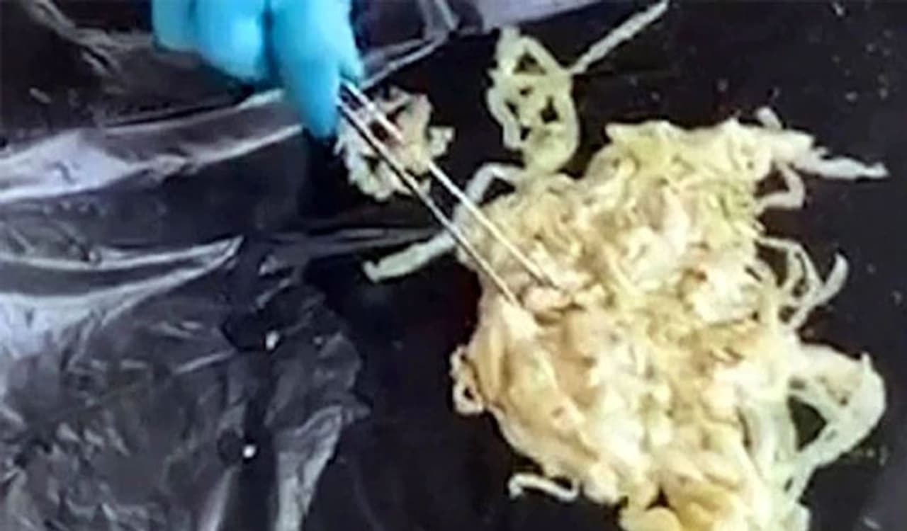 <p>ಈ ಘಟನೆ ಥಾಯ್ಲೆಂಡ್ನ ನೋಂಗ್ಖಾಯಿ ಪ್ರಾಂತ್ಯದಲ್ಲಿ ನಡೆದಿದೆ. ಇಲ್ಲಿನ 67 ವರ್ಷದ ವ್ಯಕ್ತಿಯೊಬ್ಬನ ಹೊಟ್ಟೆಯಿಂದ ವೈದ್ಯರು 59 ಅಡಿ ಉದ್ದದ ಹುಳವನ್ನು ತೆಗೆದಿದ್ದಾರೆ. ಈ ಹುಳ ದೀರ್ಘ ಕಾಲದಿಂದ ಈ ವ್ಯಕ್ತಿಯ ಹೊಟ್ಟೆಯಲ್ಲಿತ್ತು ಎಂಬುವುದು ವೈದ್ಯರ ಮಾತಾಗಿದೆ.</p> <p>ಈ ಘಟನೆ ಥಾಯ್ಲೆಂಡ್ನ ನೋಂಗ್ಖಾಯಿ ಪ್ರಾಂತ್ಯದಲ್ಲಿ ನಡೆದಿದೆ. ಇಲ್ಲಿನ 67 ವರ್ಷದ ವ್ಯಕ್ತಿಯೊಬ್ಬನ ಹೊಟ್ಟೆಯಿಂದ ವೈದ್ಯರು 59 ಅಡಿ ಉದ್ದದ ಹುಳವನ್ನು ತೆಗೆದಿದ್ದಾರೆ. ಈ ಹುಳ ದೀರ್ಘ ಕಾಲದಿಂದ ಈ ವ್ಯಕ್ತಿಯ ಹೊಟ್ಟೆಯಲ್ಲಿತ್ತು ಎಂಬುವುದು ವೈದ್ಯರ ಮಾತಾಗಿದೆ.</p>