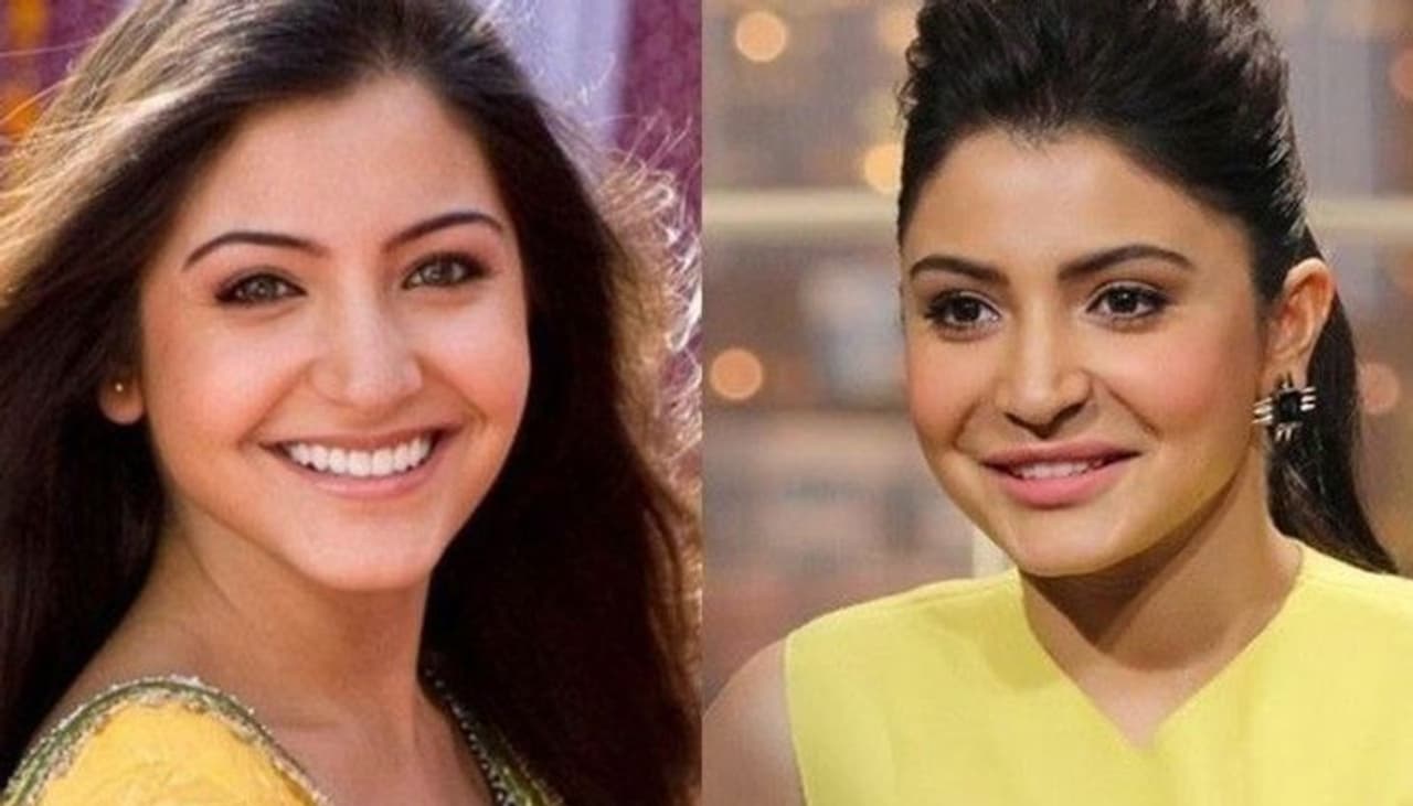 <p>Bollywood actress Anushka Sharma once got massively trolled for the disastrous lip job. It was the time when she was promoting her film Bombay Velvet. </p> <p>Bollywood actress Anushka Sharma once got massively trolled for the disastrous lip job. It was the time when she was promoting her film Bombay Velvet. </p>