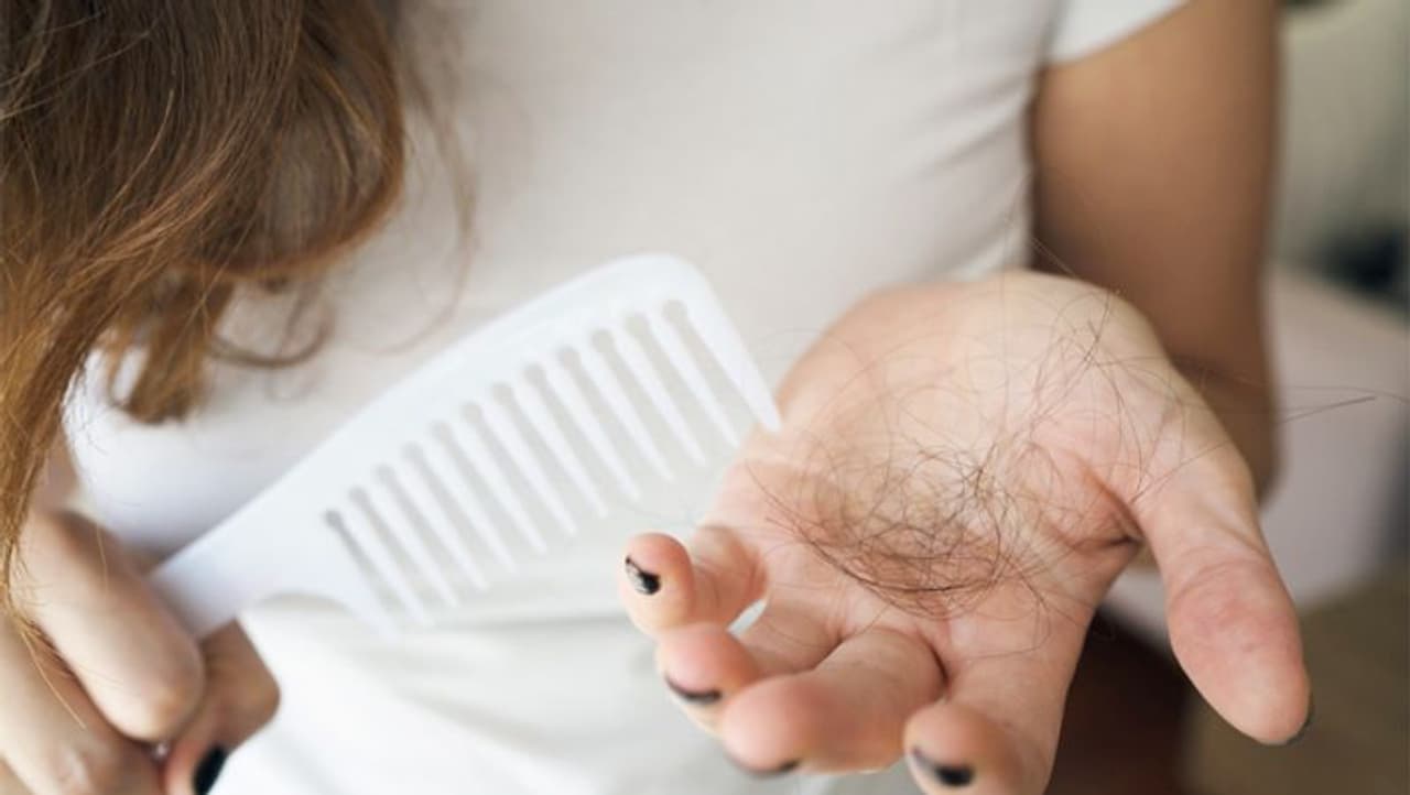 <p>ಕೂದಲು ಉದುರುವಿಕೆ ಸಮಸ್ಯೆ ಸಾಮಾನ್ಯ. ಒಂದು ದಿನದಲ್ಲಿ ಸುಮಾರು 50 100 ಕೂದಲು ಉದುರುತ್ತವೆ. ಅದನ್ನು ಸಮಸ್ಯೆ ಎನ್ನಲಾಗುವುದಿಲ್ಲ. ಅದಕ್ಕಿಂತ ಹೆಚ್ಚು ಕೂದಲು ಉದುರಿದರೆ ಸಮಸ್ಯೆ. ಇದು ಪುರುಷರಿಗೆ ಹೋಲಿಕೆ ಮಾಡಿದರೆ ಮಹಿಳೆಯರಲ್ಲಿ ಹೆಚ್ಚಾಗಿ ಕಾಡುತ್ತದೆ.</p> <p>ಕೂದಲು ಉದುರುವಿಕೆ ಸಮಸ್ಯೆ ಸಾಮಾನ್ಯ. ಒಂದು ದಿನದಲ್ಲಿ ಸುಮಾರು 50 100 ಕೂದಲು ಉದುರುತ್ತವೆ. ಅದನ್ನು ಸಮಸ್ಯೆ ಎನ್ನಲಾಗುವುದಿಲ್ಲ. ಅದಕ್ಕಿಂತ ಹೆಚ್ಚು ಕೂದಲು ಉದುರಿದರೆ ಸಮಸ್ಯೆ. ಇದು ಪುರುಷರಿಗೆ ಹೋಲಿಕೆ ಮಾಡಿದರೆ ಮಹಿಳೆಯರಲ್ಲಿ ಹೆಚ್ಚಾಗಿ ಕಾಡುತ್ತದೆ.</p>