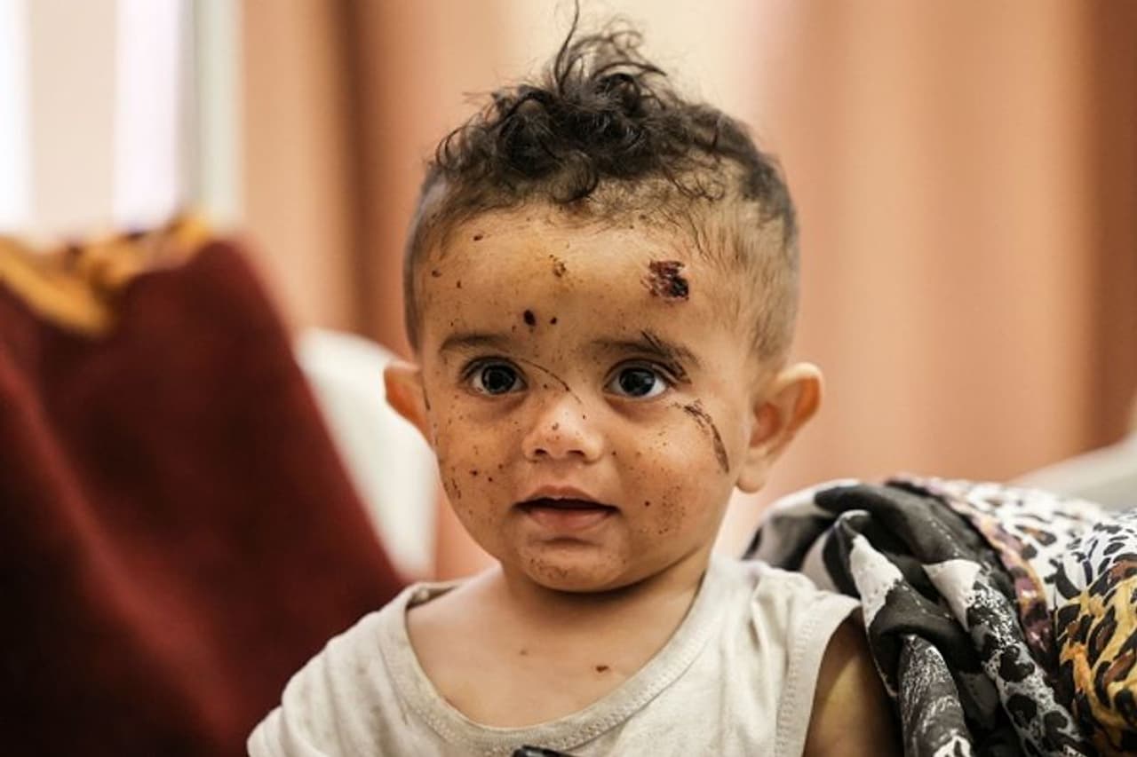 <p>പതിറ്റാണ്ടുകള് നീണ്ട ഇസ്രയേലിന്റെ പലസ്തീന് പിടിച്ചടക്കലിനിടെ ആയിരക്കണക്കിന് മനുഷ്യ ജീവനുകള് നഷ്ടമായിട്ടുണ്ട്. എന്നാല് കഴിഞ്ഞ പതിനൊന്ന് ദിവസത്തെ യുദ്ധത്തിനിടെ ആശങ്കപ്പെടുത്തുന്ന മരണനിരക്കാണ് കുട്ടികള്ക്കിടെയിലായിരുന്നത്. </p> <p>പതിറ്റാണ്ടുകള് നീണ്ട ഇസ്രയേലിന്റെ പലസ്തീന് പിടിച്ചടക്കലിനിടെ ആയിരക്കണക്കിന് മനുഷ്യ ജീവനുകള് നഷ്ടമായിട്ടുണ്ട്. എന്നാല് കഴിഞ്ഞ പതിനൊന്ന് ദിവസത്തെ യുദ്ധത്തിനിടെ ആശങ്കപ്പെടുത്തുന്ന മരണനിരക്കാണ് കുട്ടികള്ക്കിടെയിലായിരുന്നത്. </p>