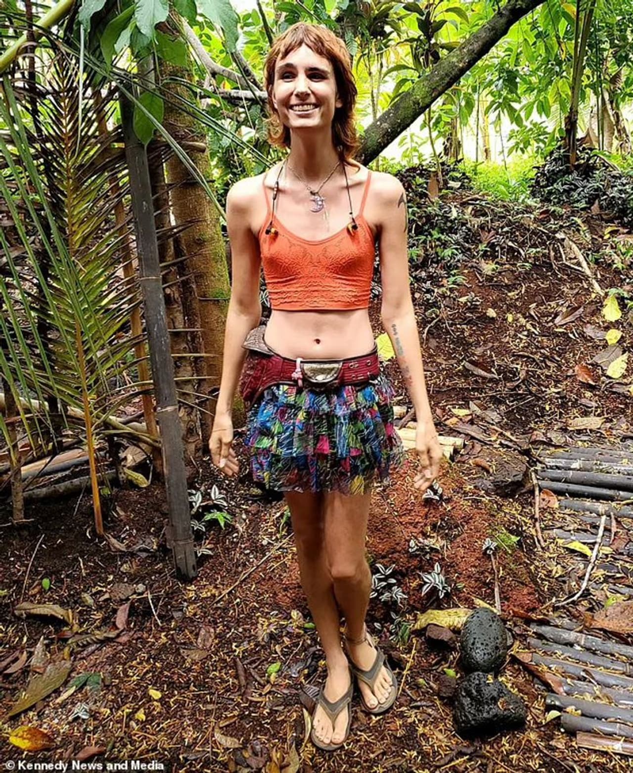 <p>യോനി തുന്നിച്ചേർക്കുന്ന ശസ്ത്രക്രിയയെക്കുറിച്ച് ഒരു പ്ലാസ്റ്റിക് സർജനുമായി ലൂണ അനിമിഷ ചർച്ചകൾ നടത്തിക്കൊണ്ടിരിക്കുകയാണ്. കൂടാതെ ലാബിൽ നിർമ്മിച്ചെടുത്ത കൃതൃമ ഗർഭപാത്രം തുന്നിച്ചർക്കുന്നതും ആലോചിക്കുന്നുണ്. ഇതിനായി ഏകദേശം 100,00 ഡോളർ ചിലവ് വരും എന്ന് അനിമിഷ പ്രതീക്ഷിക്കുന്നു.</p> <p>യോനി തുന്നിച്ചേർക്കുന്ന ശസ്ത്രക്രിയയെക്കുറിച്ച് ഒരു പ്ലാസ്റ്റിക് സർജനുമായി ലൂണ അനിമിഷ ചർച്ചകൾ നടത്തിക്കൊണ്ടിരിക്കുകയാണ്. കൂടാതെ ലാബിൽ നിർമ്മിച്ചെടുത്ത കൃതൃമ ഗർഭപാത്രം തുന്നിച്ചർക്കുന്നതും ആലോചിക്കുന്നുണ്. ഇതിനായി ഏകദേശം 100,00 ഡോളർ ചിലവ് വരും എന്ന് അനിമിഷ പ്രതീക്ഷിക്കുന്നു.</p>