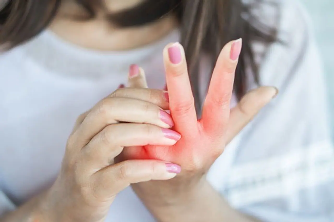 <p>Eczema is a dry skin condition which comes in different forms and varies from person to person. It is not contagious so it is safe to be around those suffering from this skin condition.</p>