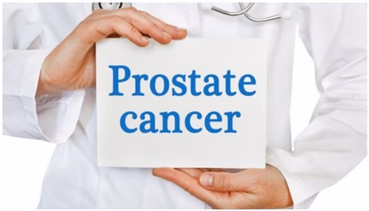 prostate cancer prostate cancer