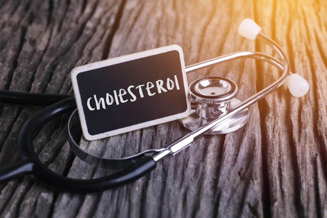 cholesterol cholesterol