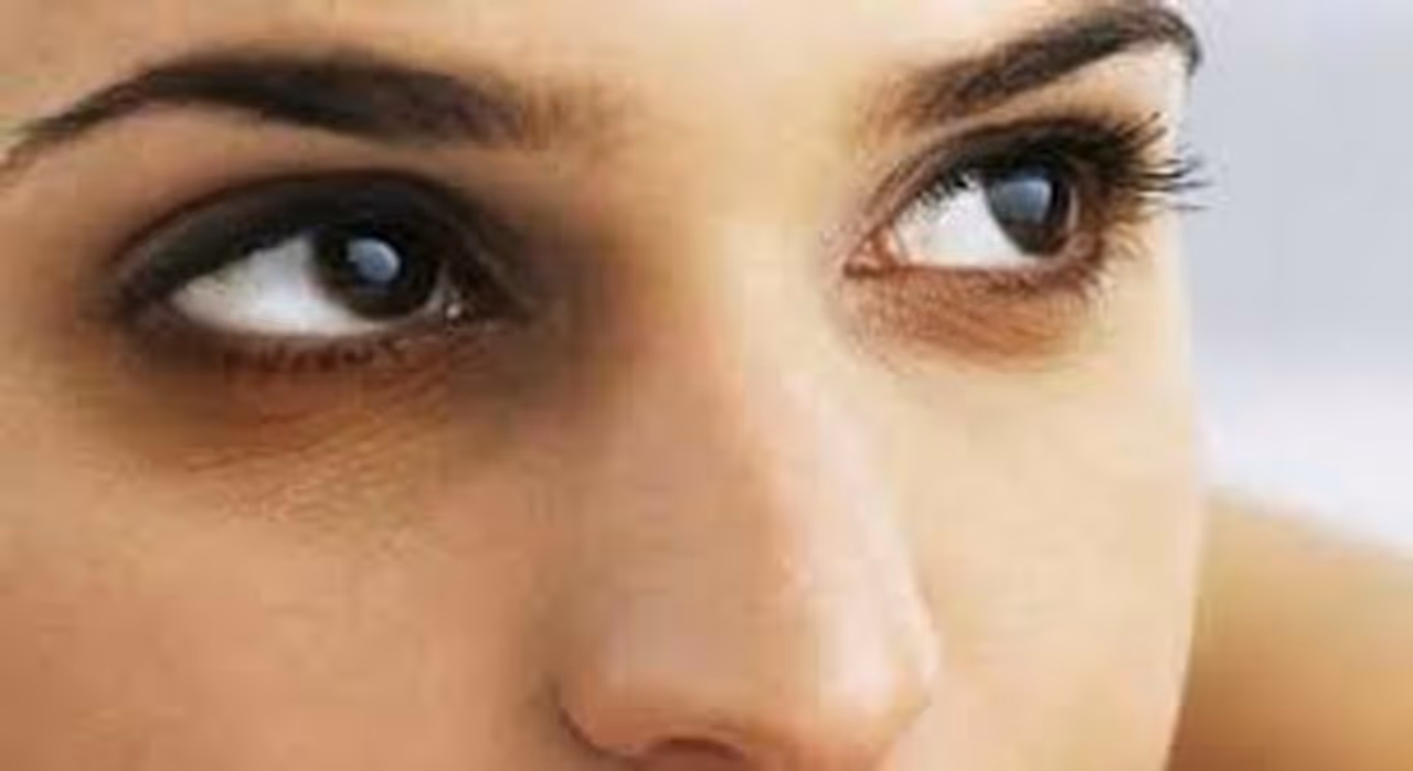 Puffy Eyes Remedy In Tamil