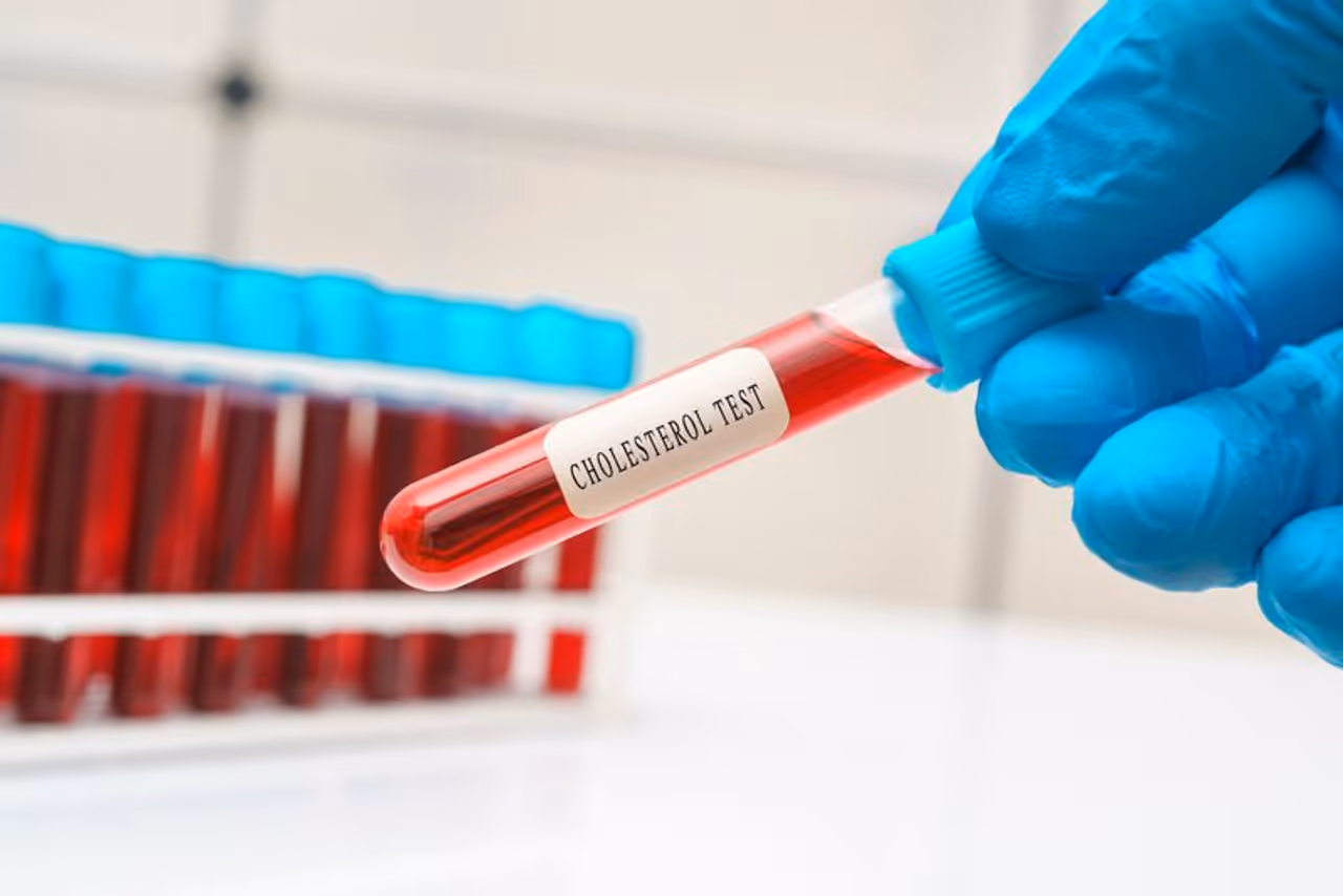 High Cholesterol High Cholesterol