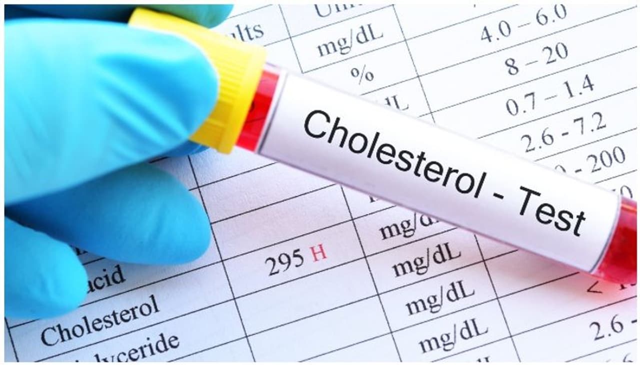 good cholesterol good cholesterol