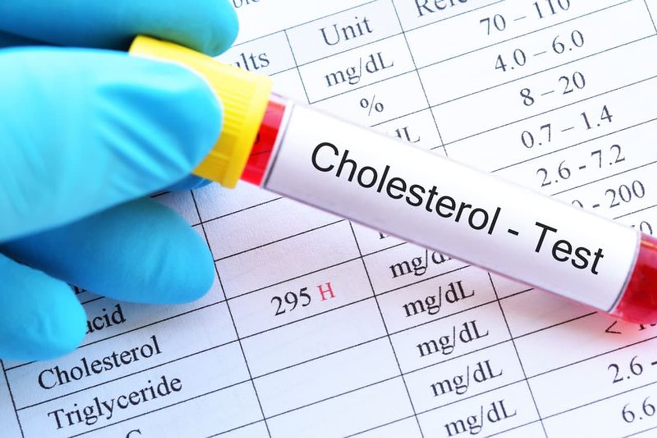 cholesterol cholesterol