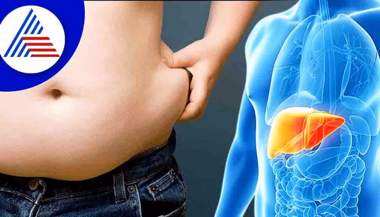 World liver day 2022: World liver day 2022: