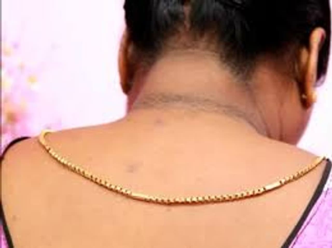 Remove Neck Darkness Home Remedy