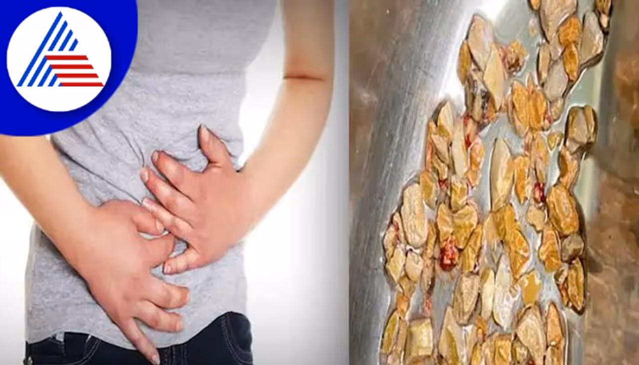 Kidney Detox Drinks: Kidney Detox Drinks: