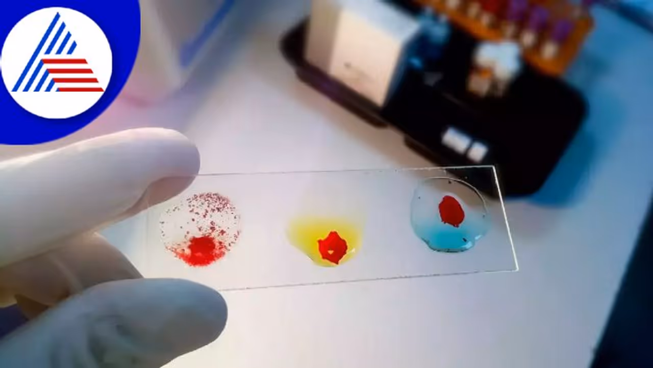 blood group blood group