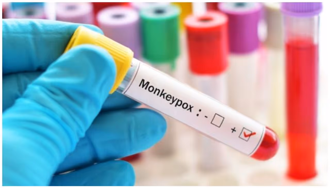 monkeypox